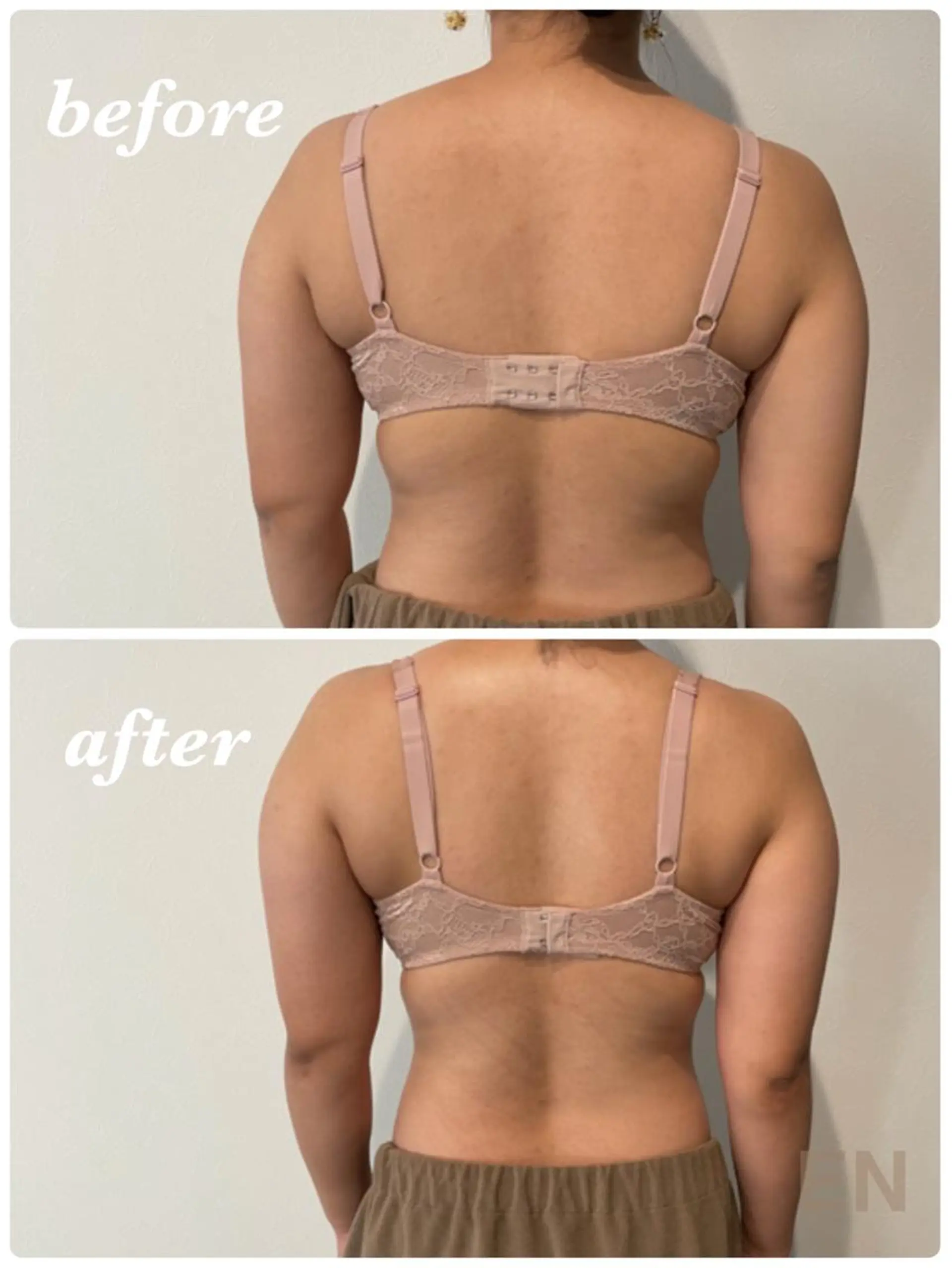 Monreve所属・美人スイッチdiet スーパージェクションのその他イメージ