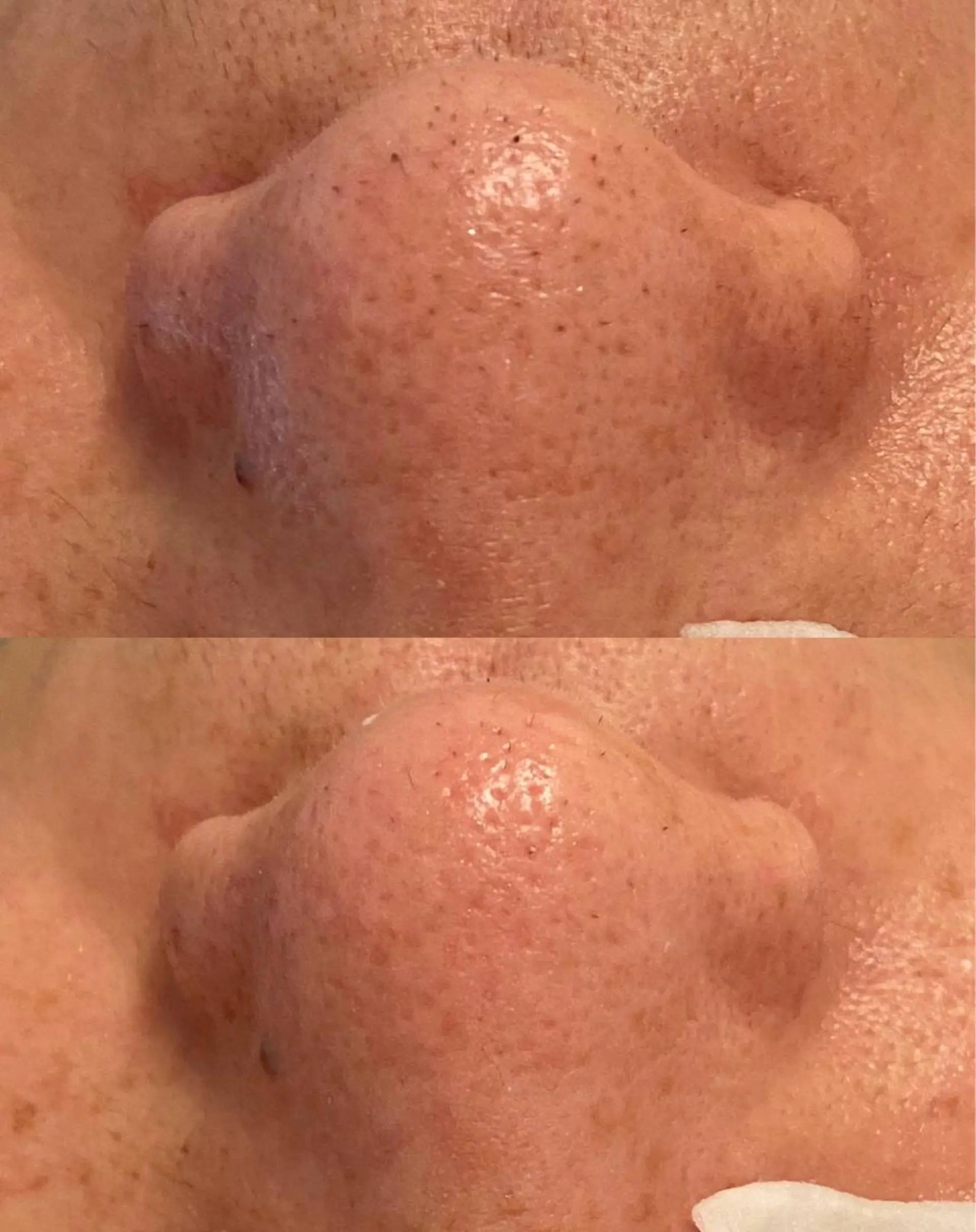 メンズ Remina clinical salon所属・ハイフ美肌専門 Remina.c.sのエステ・リラクイメージ