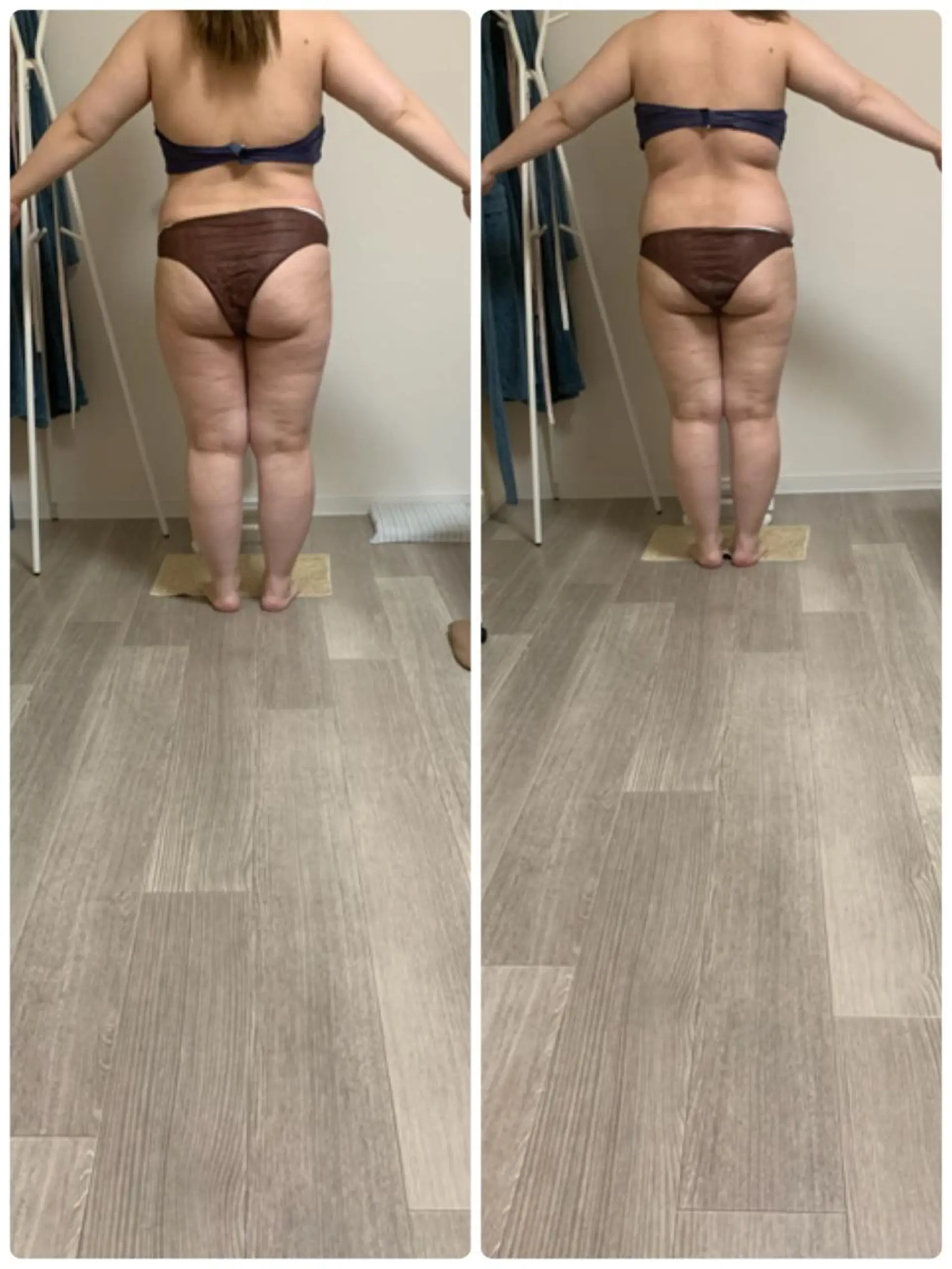 美ボディメイクサロン　only one body所属・所沢 痩身エステサロンのエステ・リラクイメージ