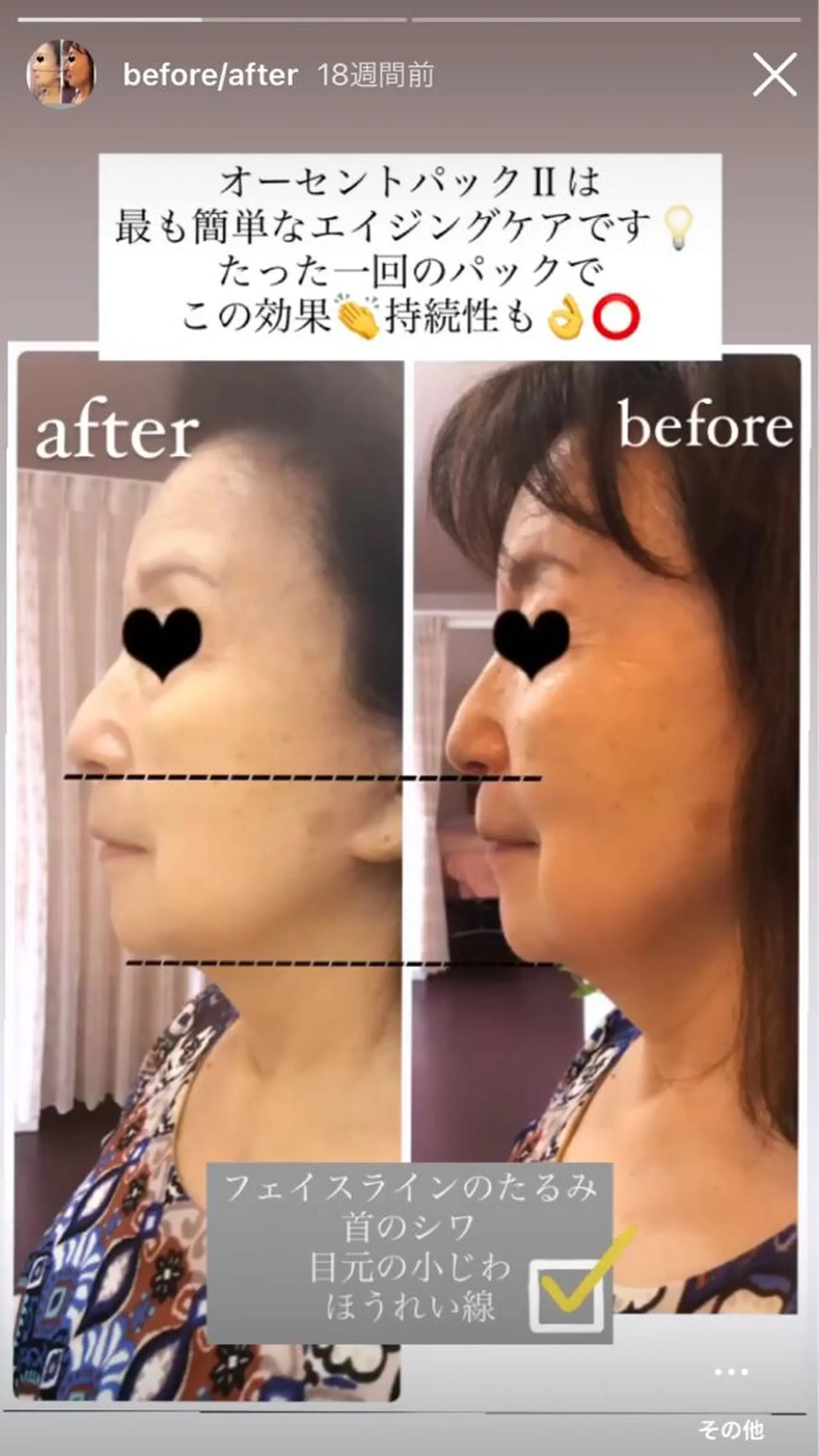 フェイシャル専門店 MENARD伊勢崎のエステ・リラクイメージ