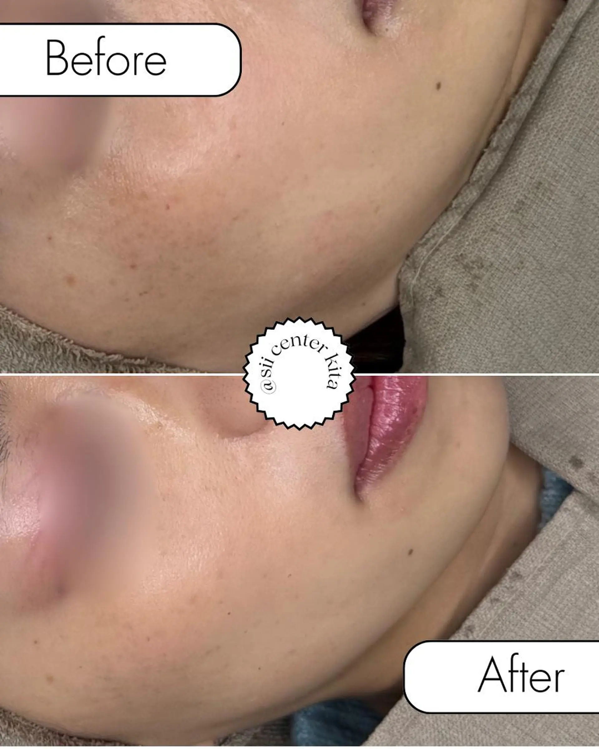 その他 sii MIUのエステ・リラクイメージ