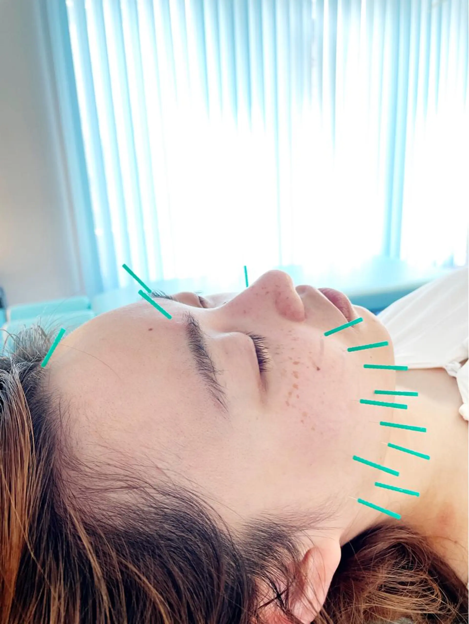 小顔美容鍼専門サロン 渋谷YZのエステ・リラクイメージ