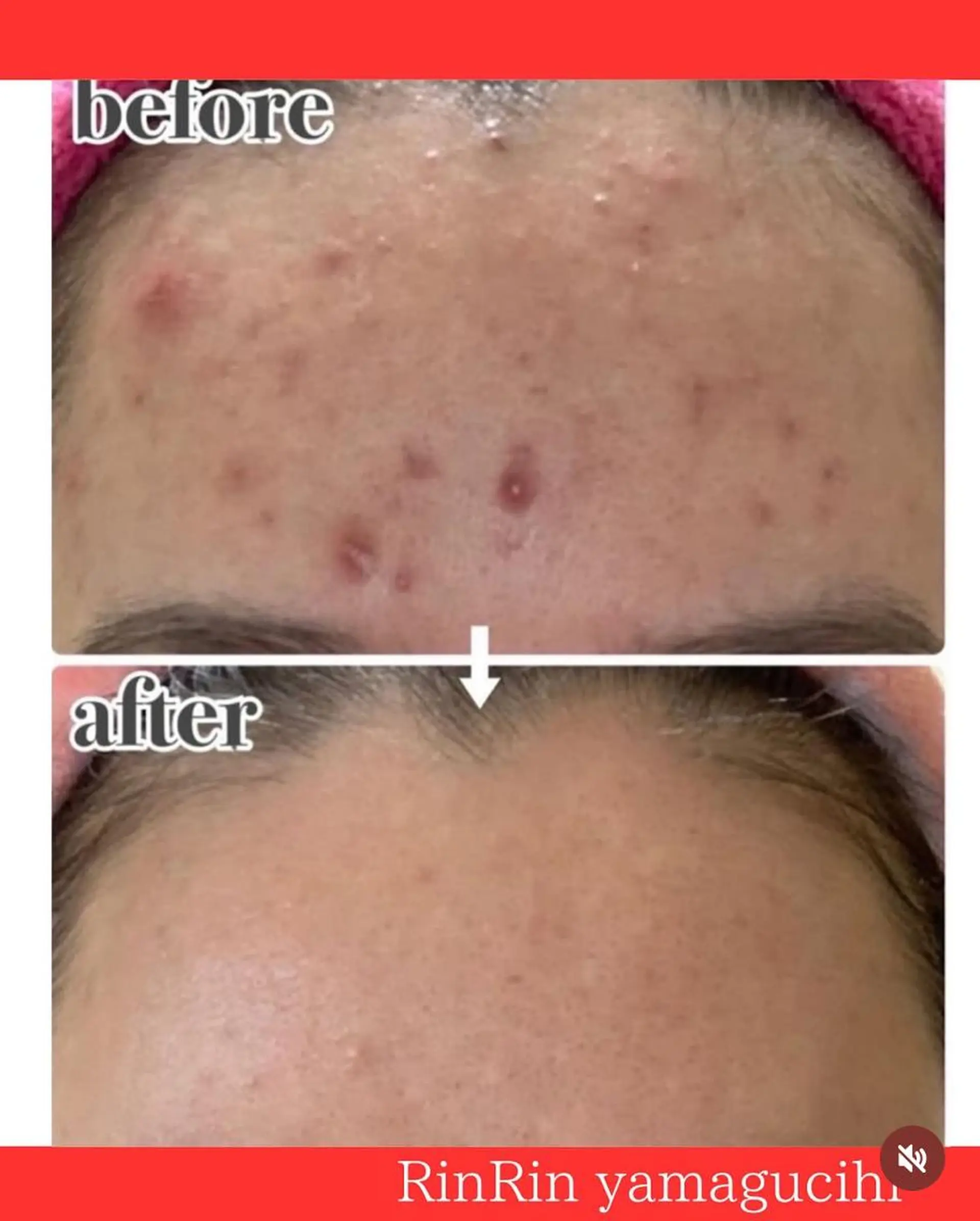 RinRin 山口店のエステ・リラクイメージ