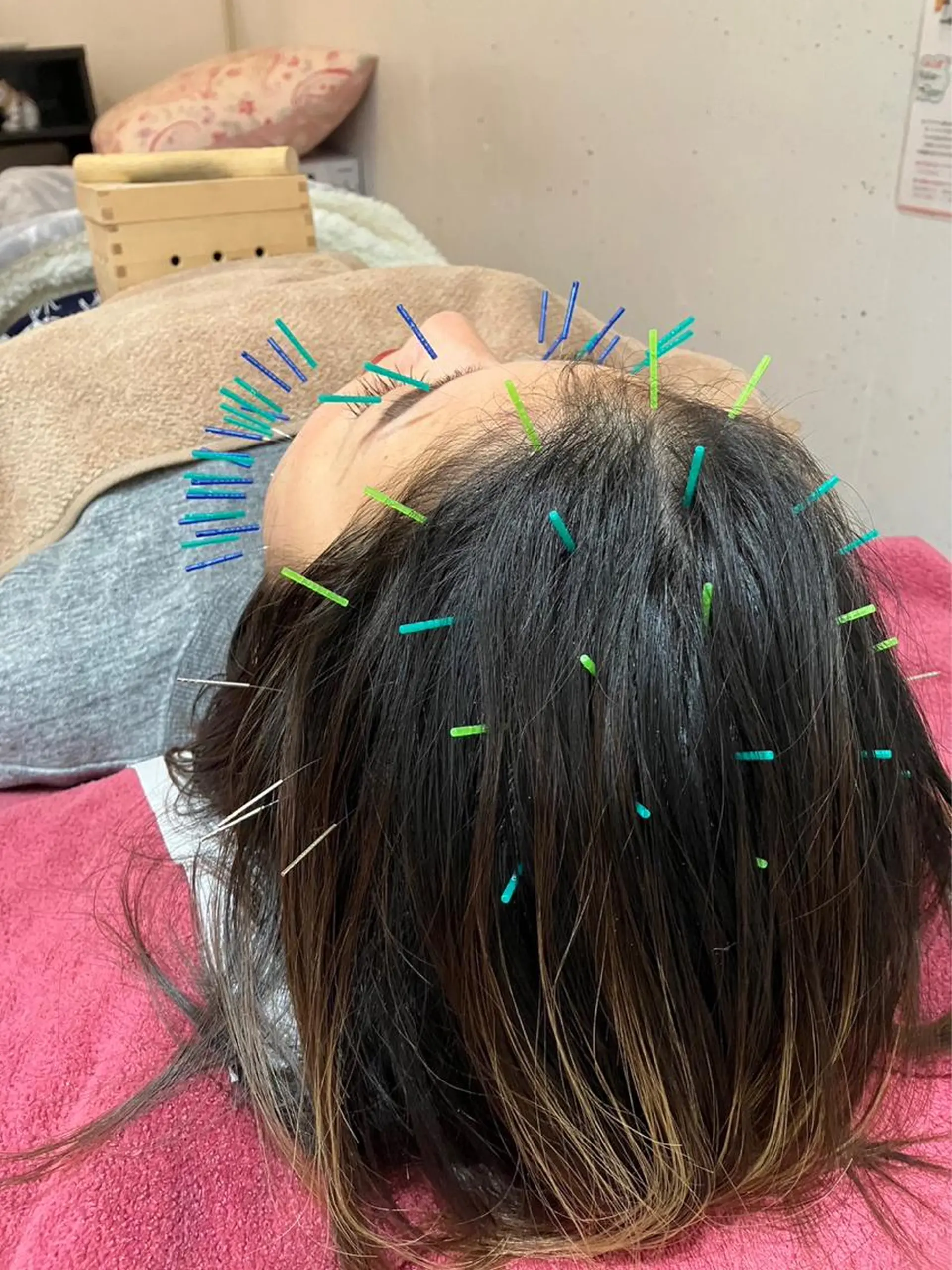 エステ リラク 美容鍼灸女性専用 りんご鍼灸治療院のその他イメージ