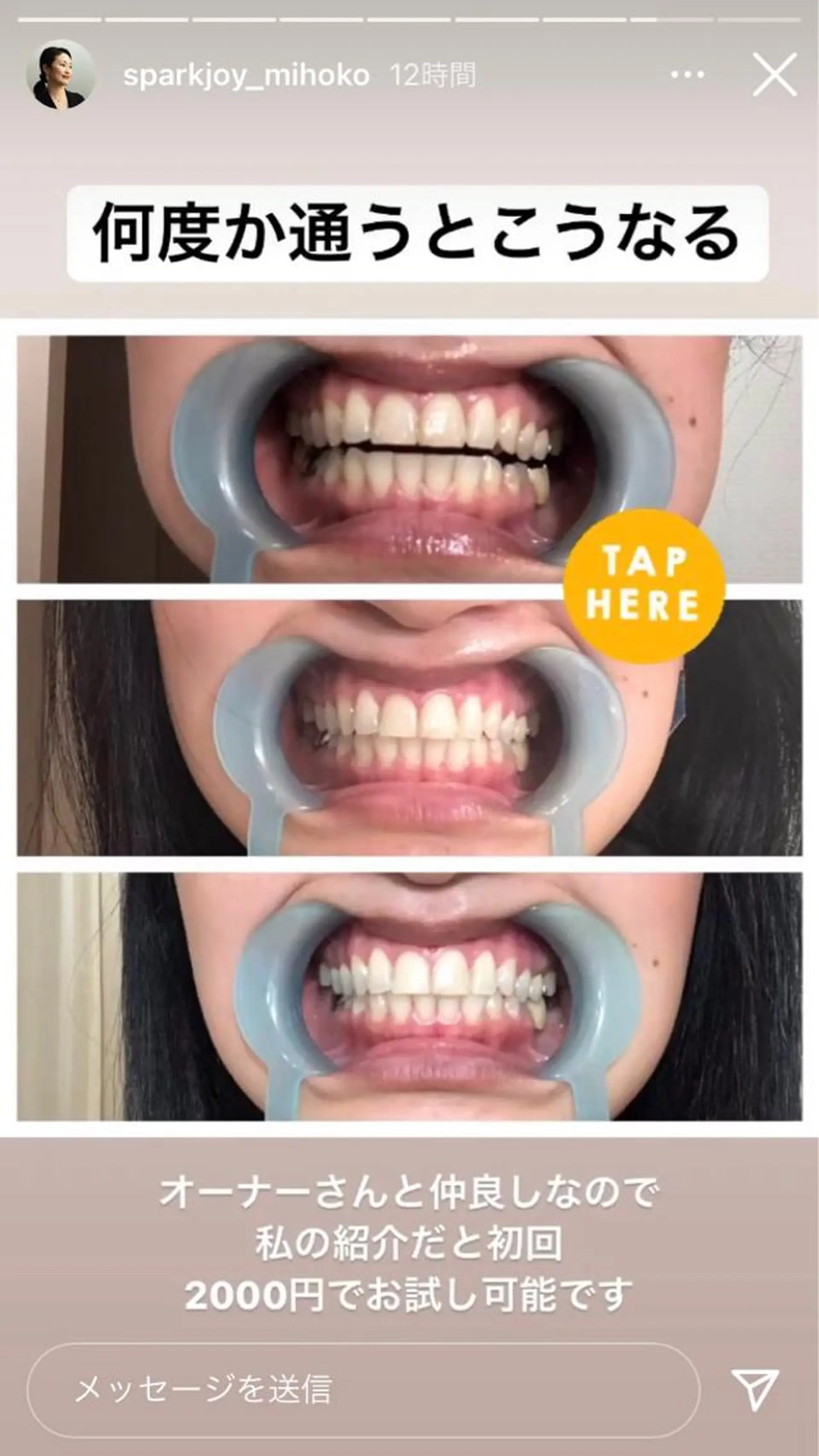 M渋谷店所属・Ｍ渋谷 ホワイトニングのエステ・リラクイメージ