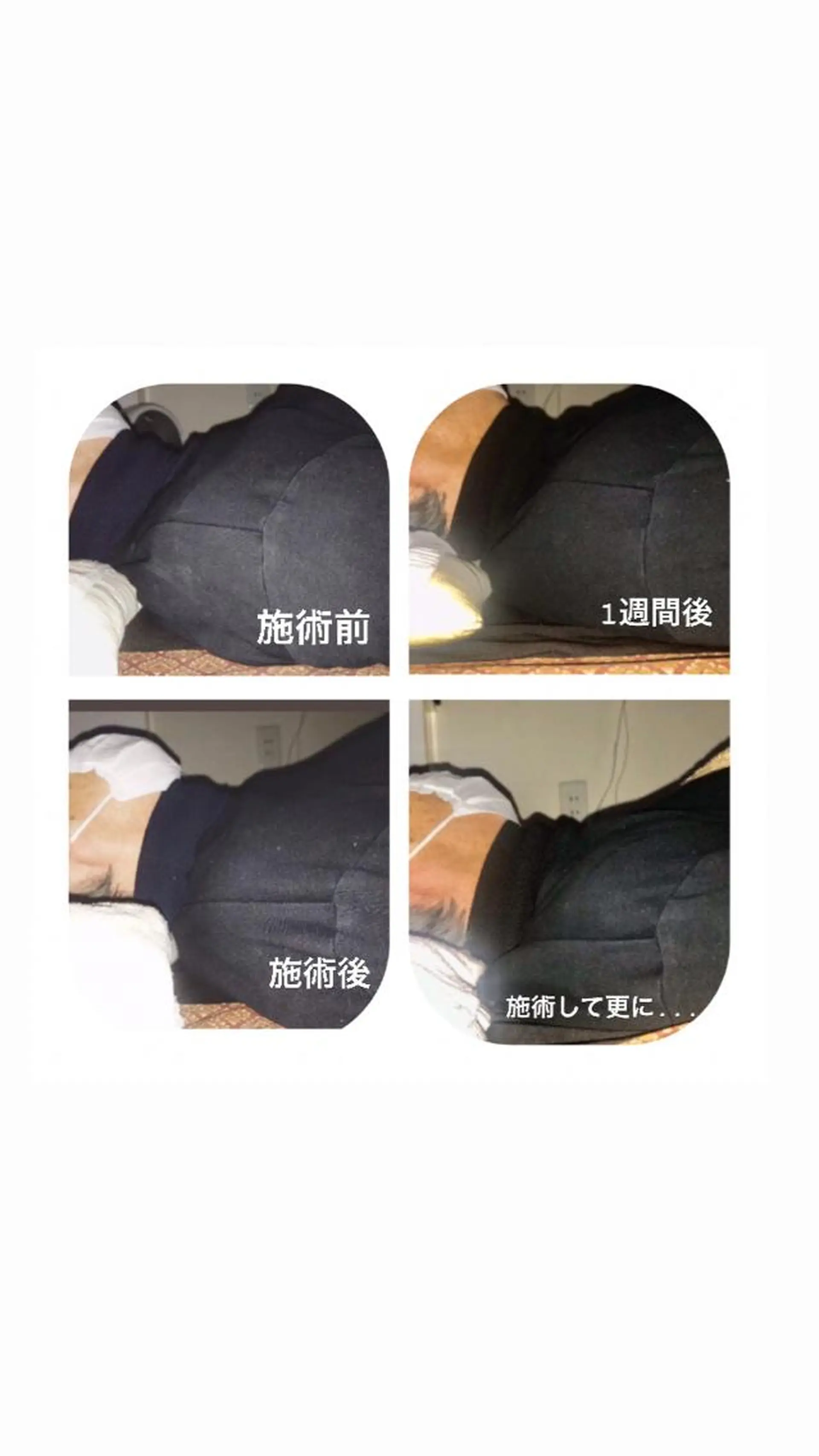 リラク 【足圧】鬼👹リンパ 身体整うサロンのエステ・リラクイメージ