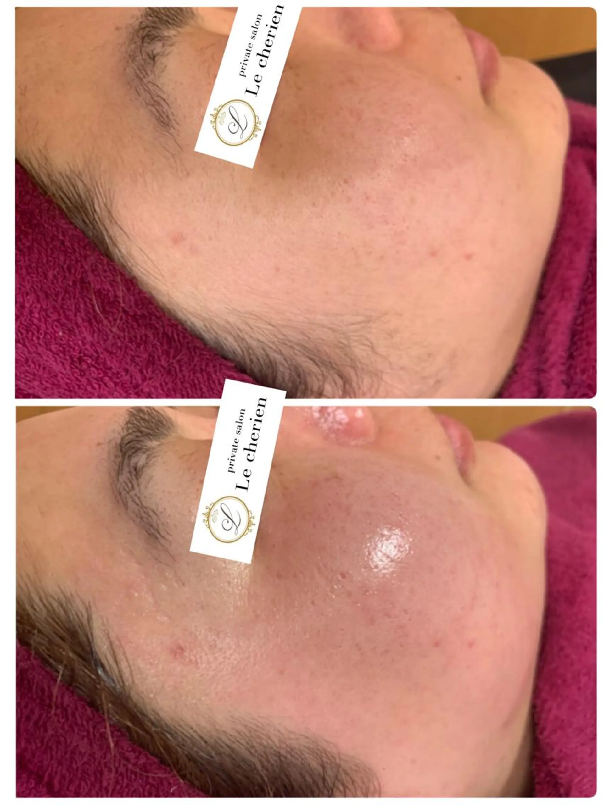 脱毛 Le cherien所属・Le cherien ルシェリアのエステ・リラクイメージ