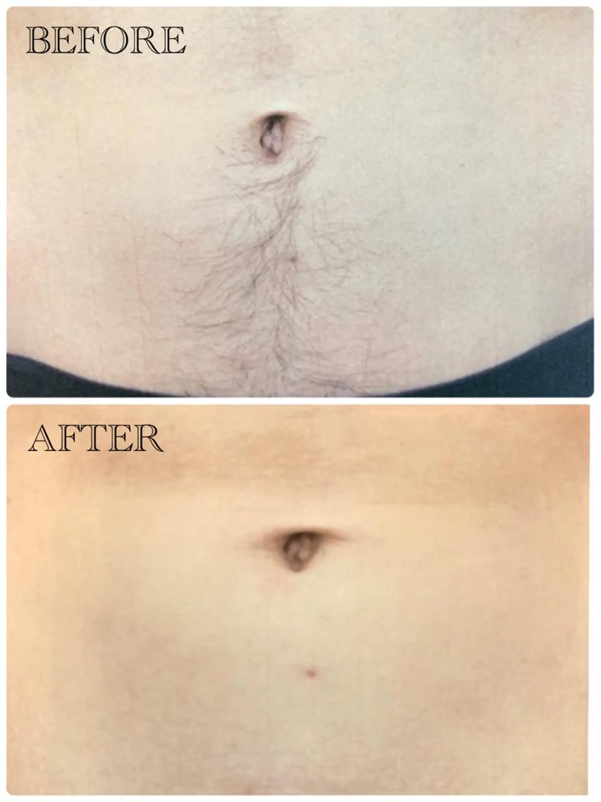 ❤️セルフ脱毛サロン jewel nailのエステ・リラクイメージ