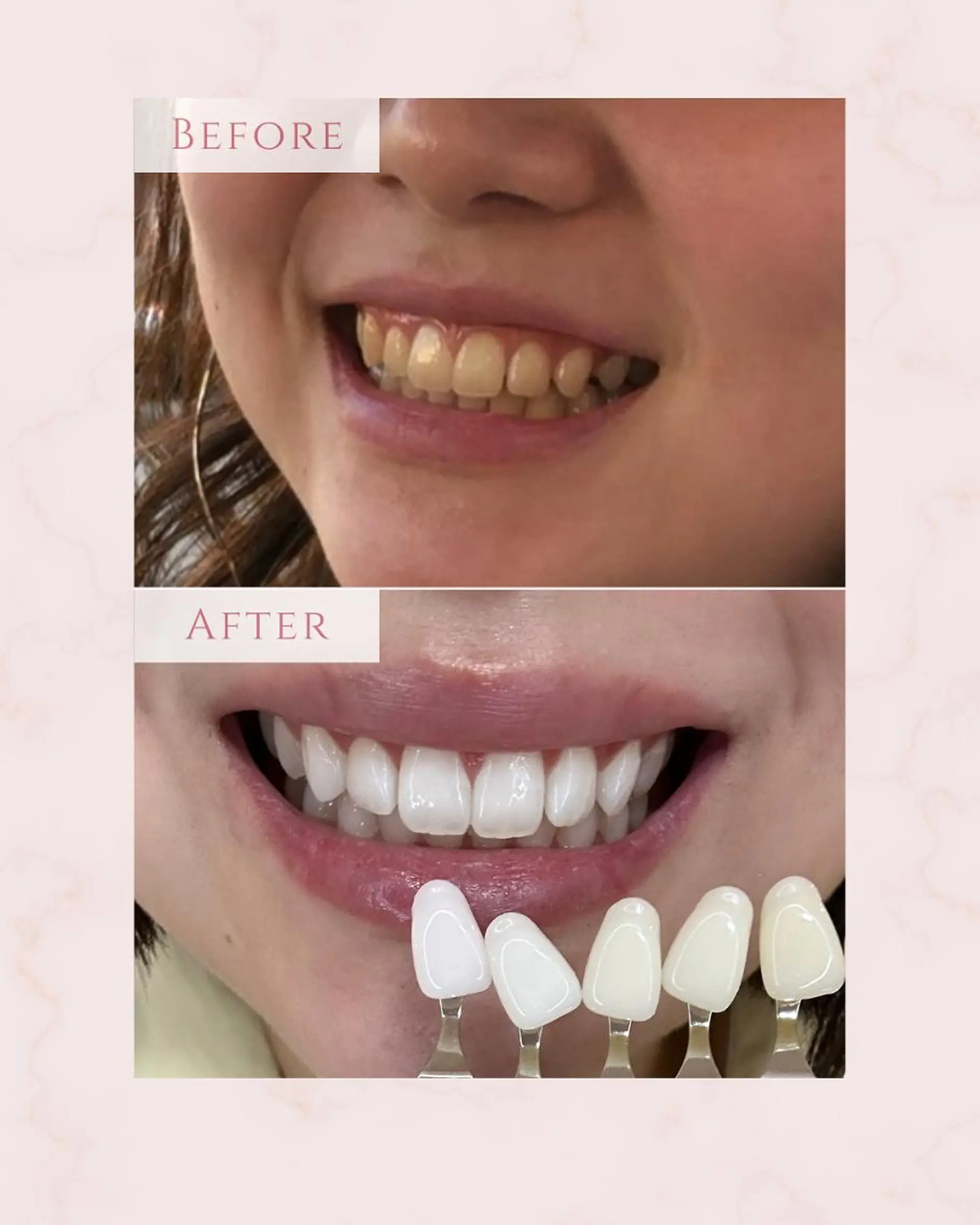 Whitening Carat 恵比寿店所属・ホワイトニング カラット 恵比寿店のエステ・リラクイメージ