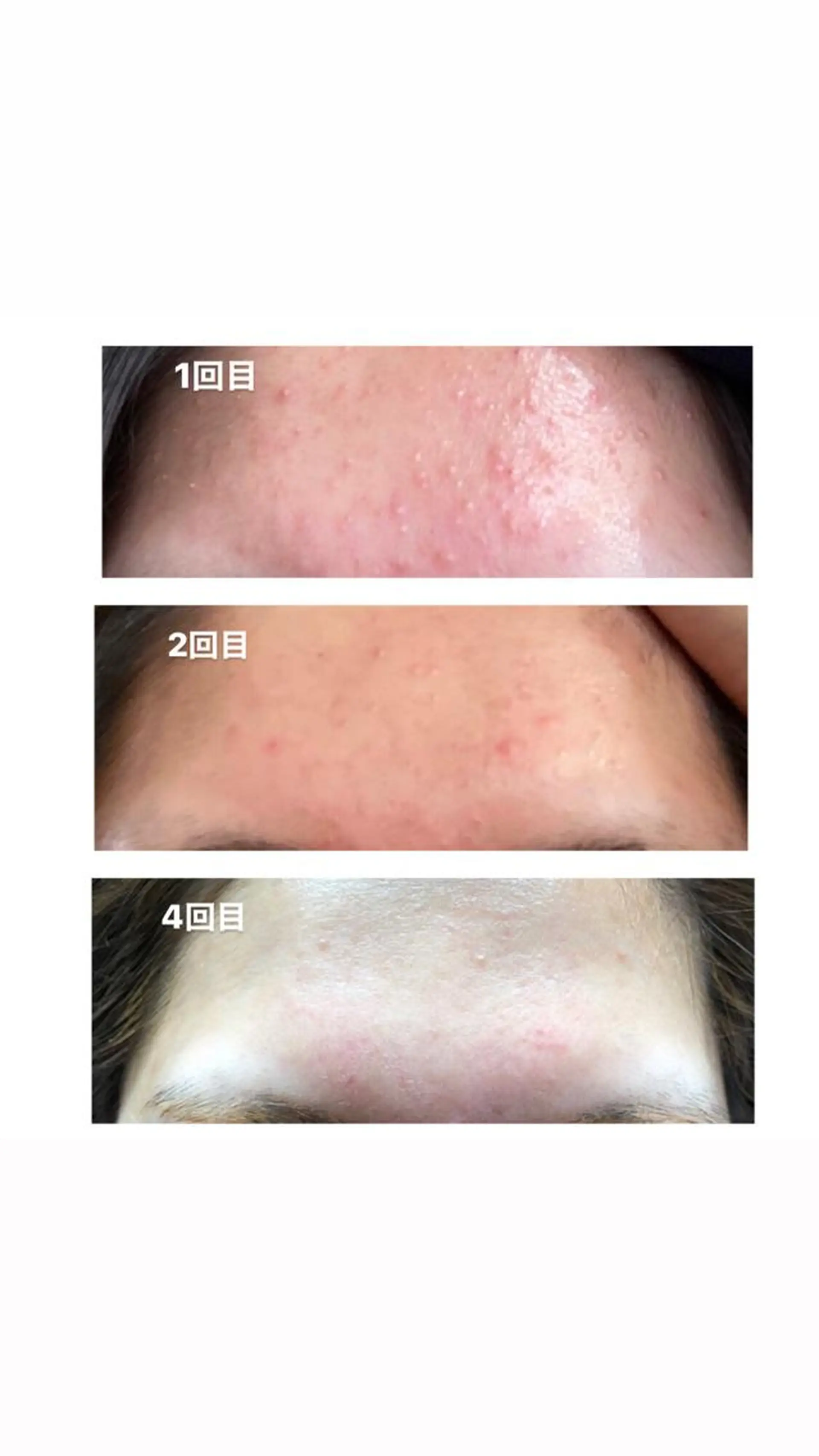 エステ i'llbe  イルビー 脱毛・エステサロン所属・i'llbe イルビーのエステ・リラクイメージ