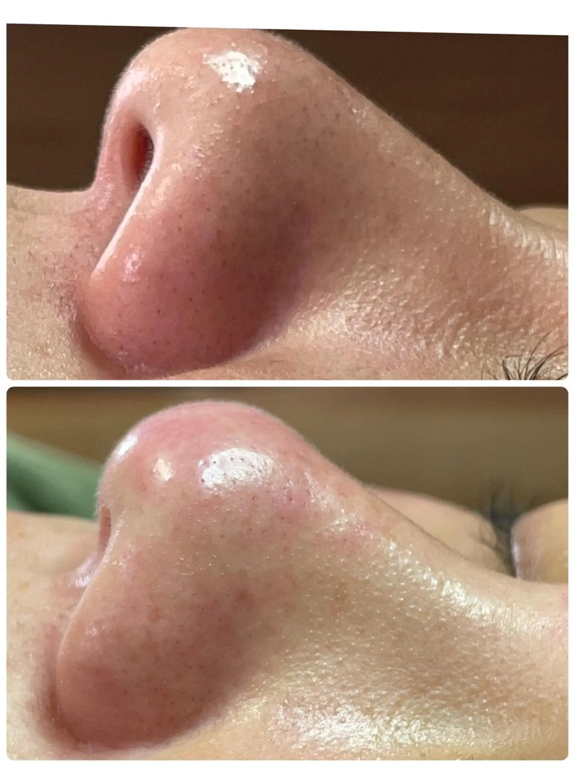 private salon  Dea_maris シュガーリング＆パーソナルボディケア所属・シミ改善・韓国肌管理 ボディメイク痩身のその他イメージ