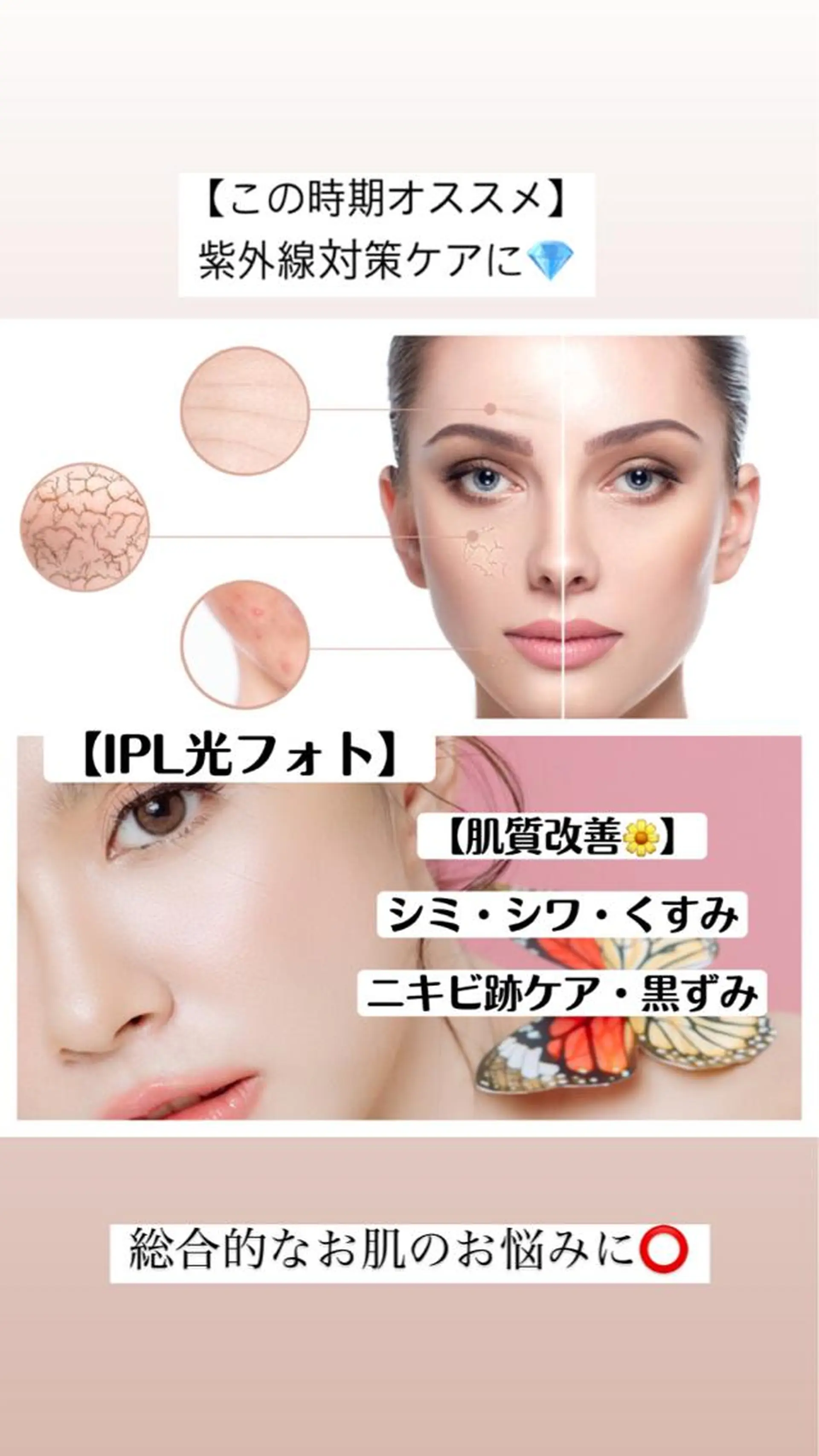 セミロング カラー パーマ ヘアアレンジ メンズ キッズ ネイル マツエク・マツパ アイブロウ Chloe-クロエ- 脱毛/フェイシャルのエステ・リラクイメージ