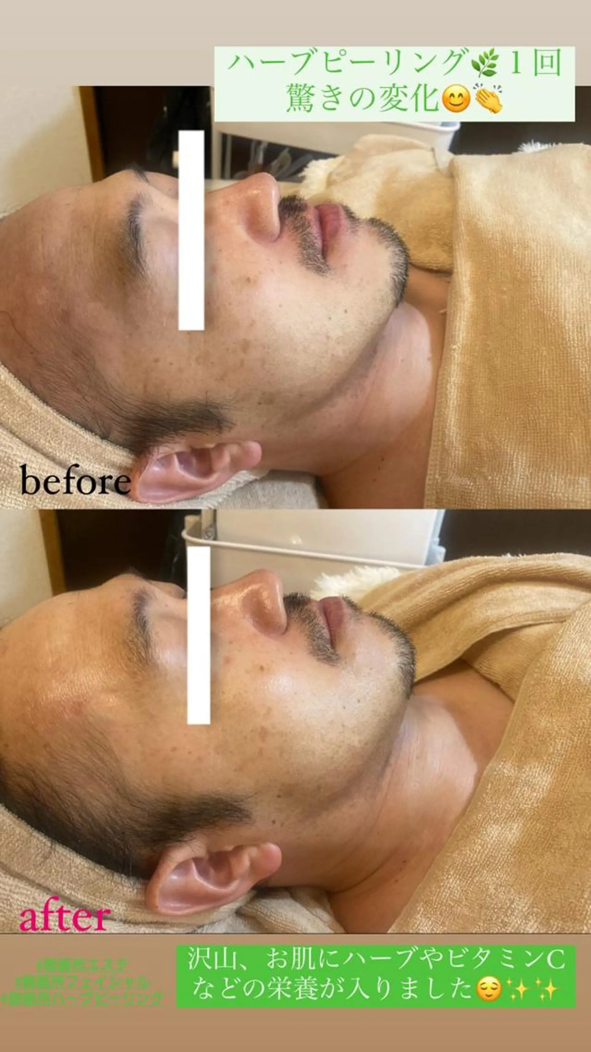 エステ Salon de Lino 御器所のエステ・リラクイメージ