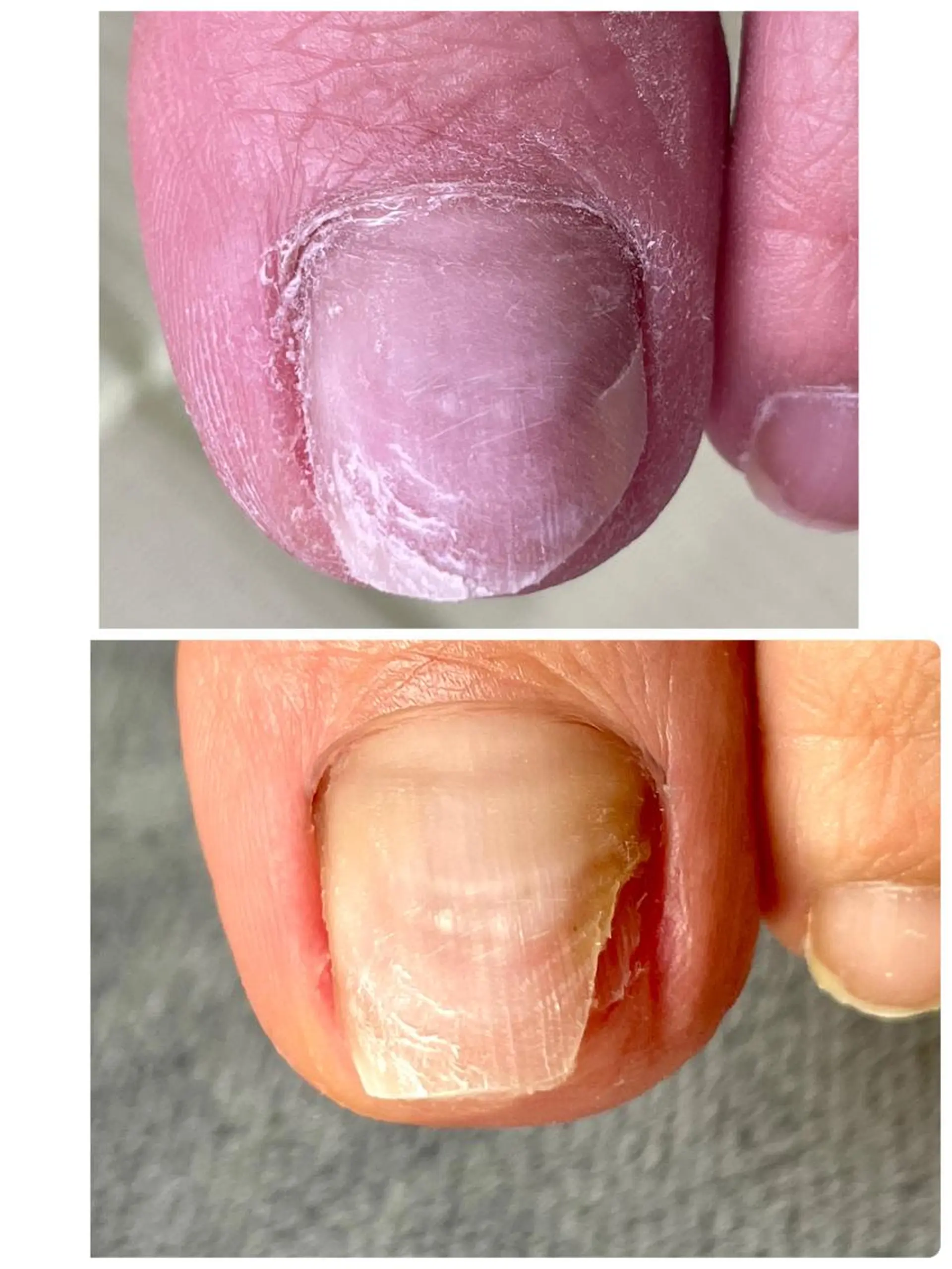 メンズ ネイル Chérinail 爪のお手入れのネイルデザイン