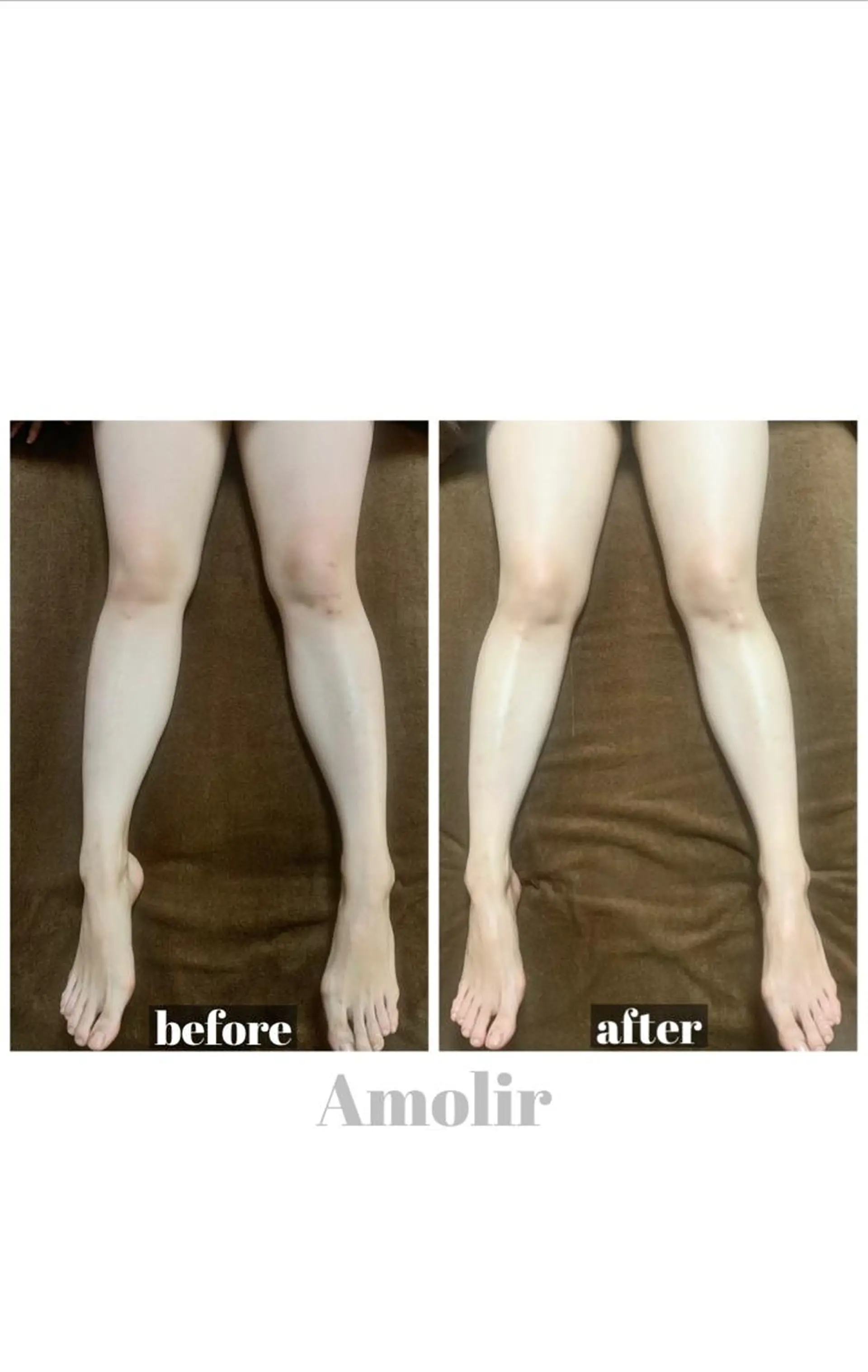 30代以降のボディ メイク Amolirのエステ・リラクイメージ