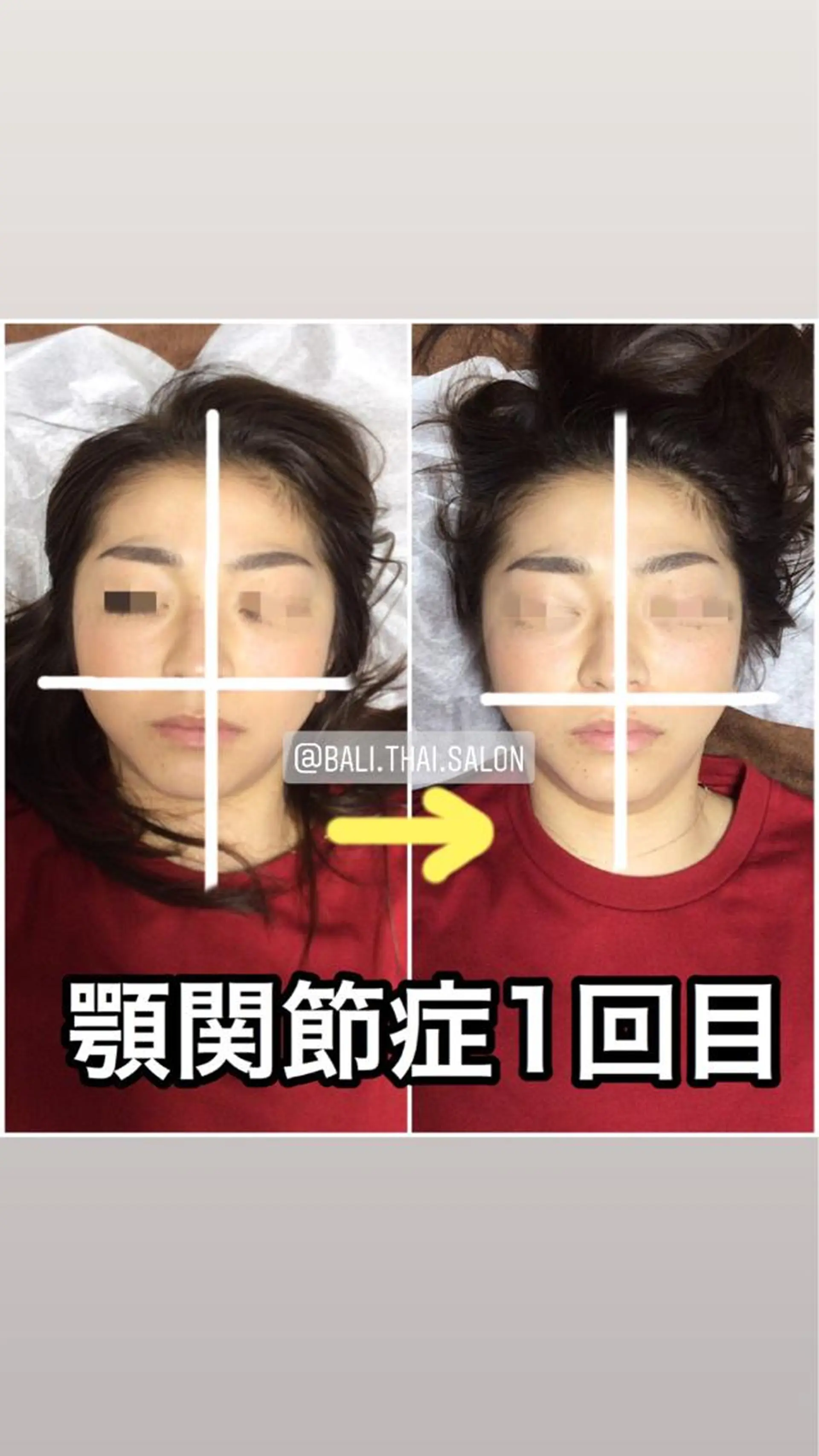 🌈歪み改善🌈 バリンタイ すぎうらのエステ・リラクイメージ