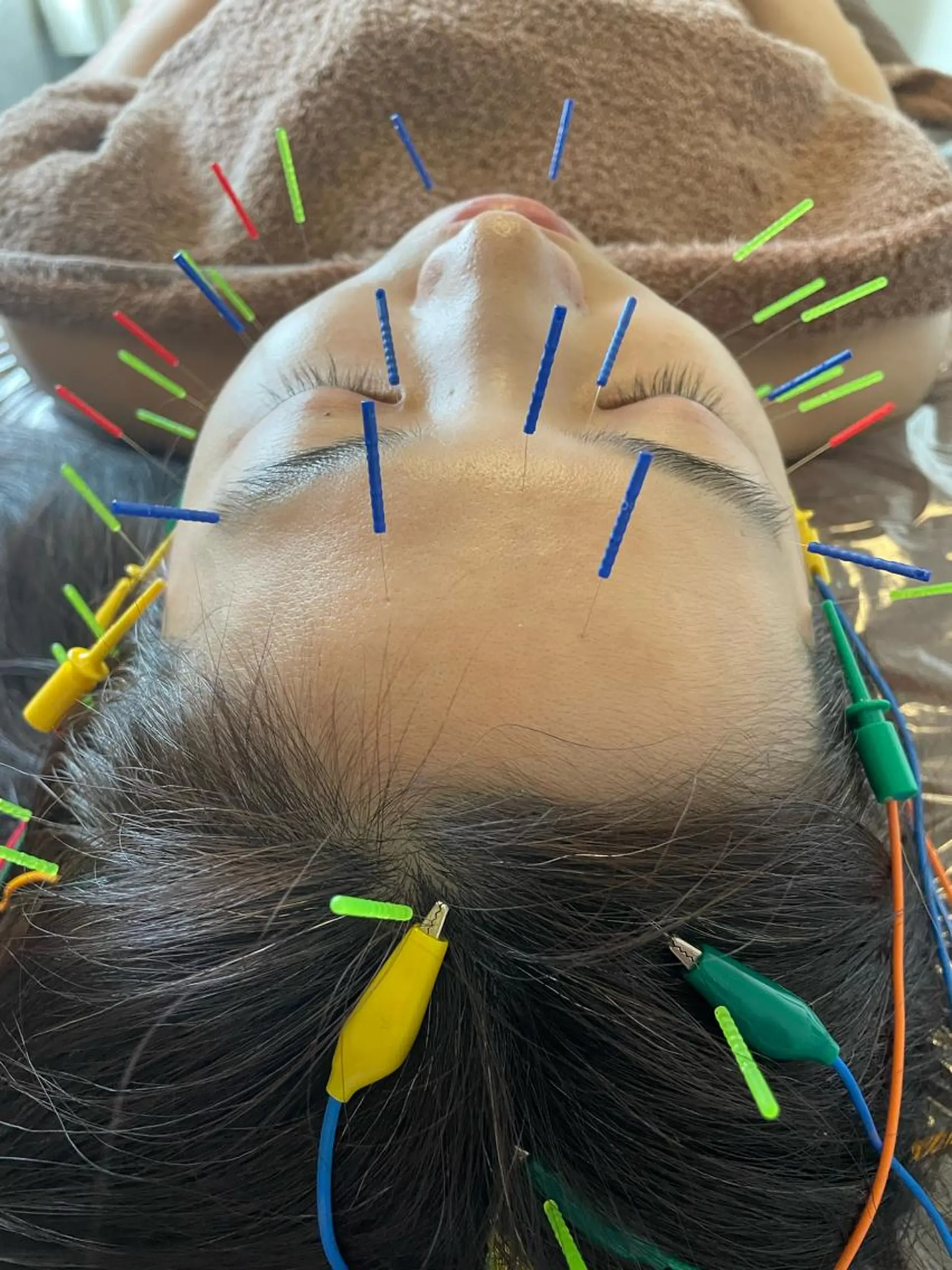 美容鍼灸サロン mahoroba院長のエステ・リラクイメージ