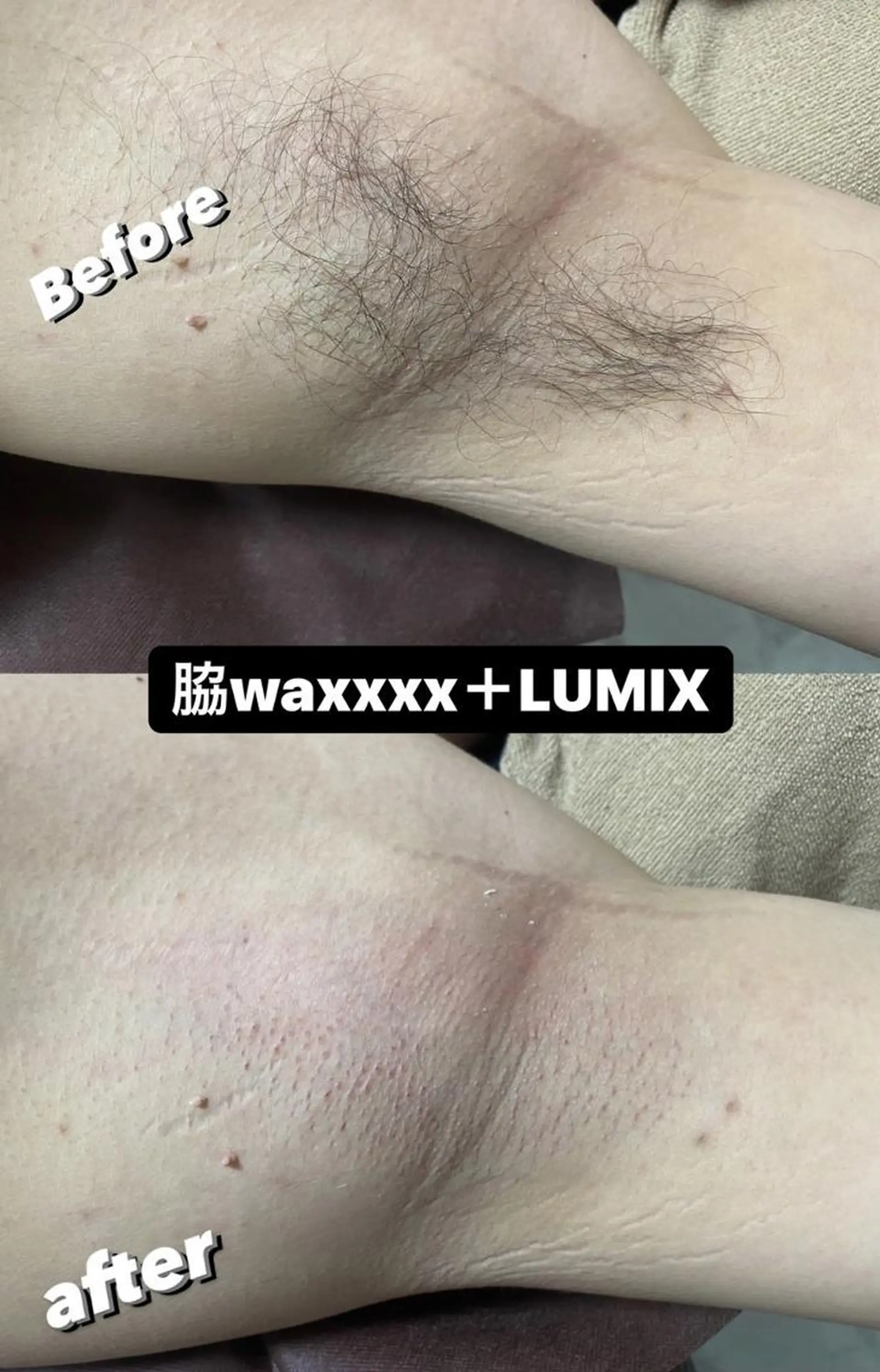 メンズ 脱毛 Epina 千葉店 【エピナ】のエステ・リラクイメージ