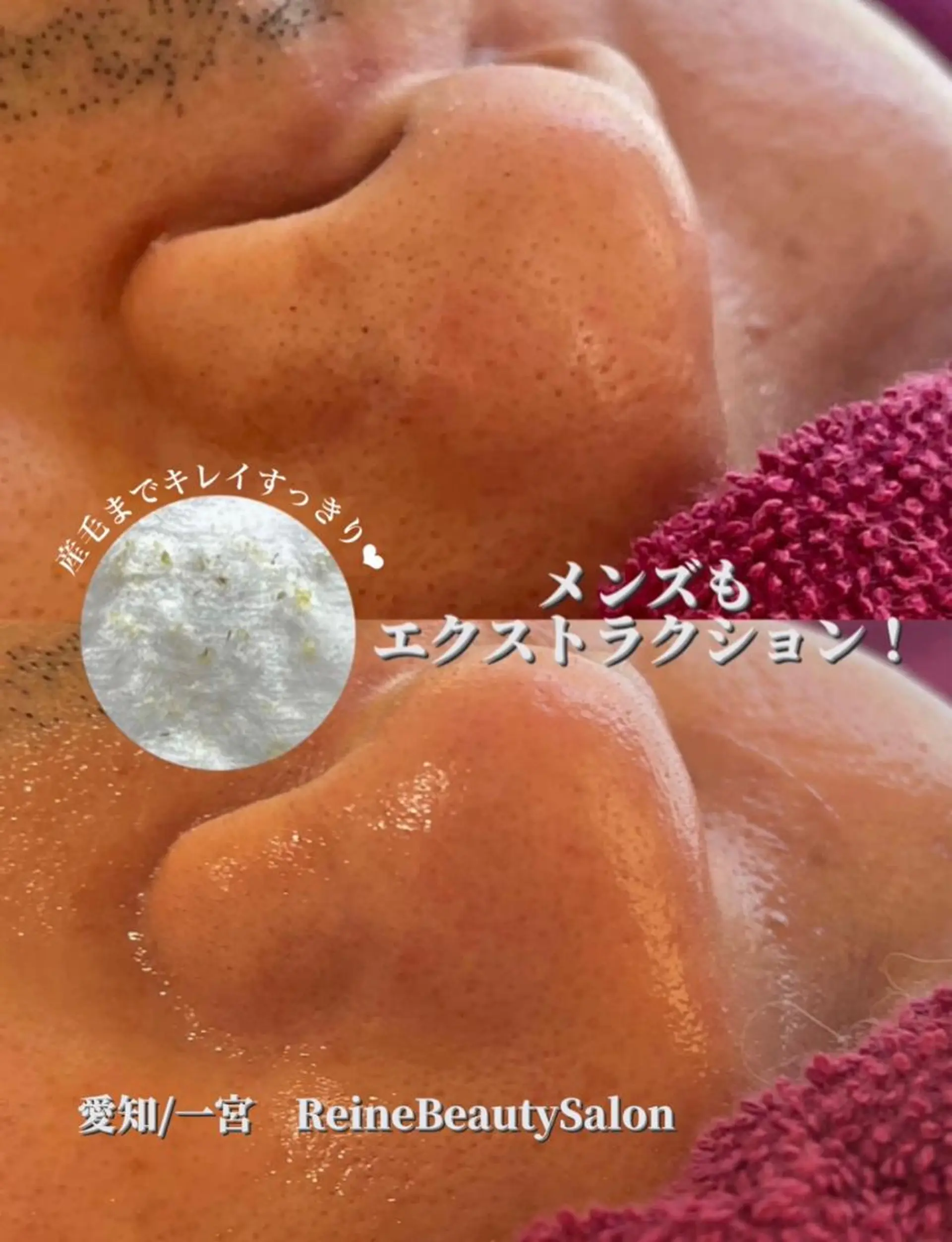 Reine BeautySalon所属・毛穴/シミ肝斑/脱毛 横山梨里のエステ・リラクイメージ