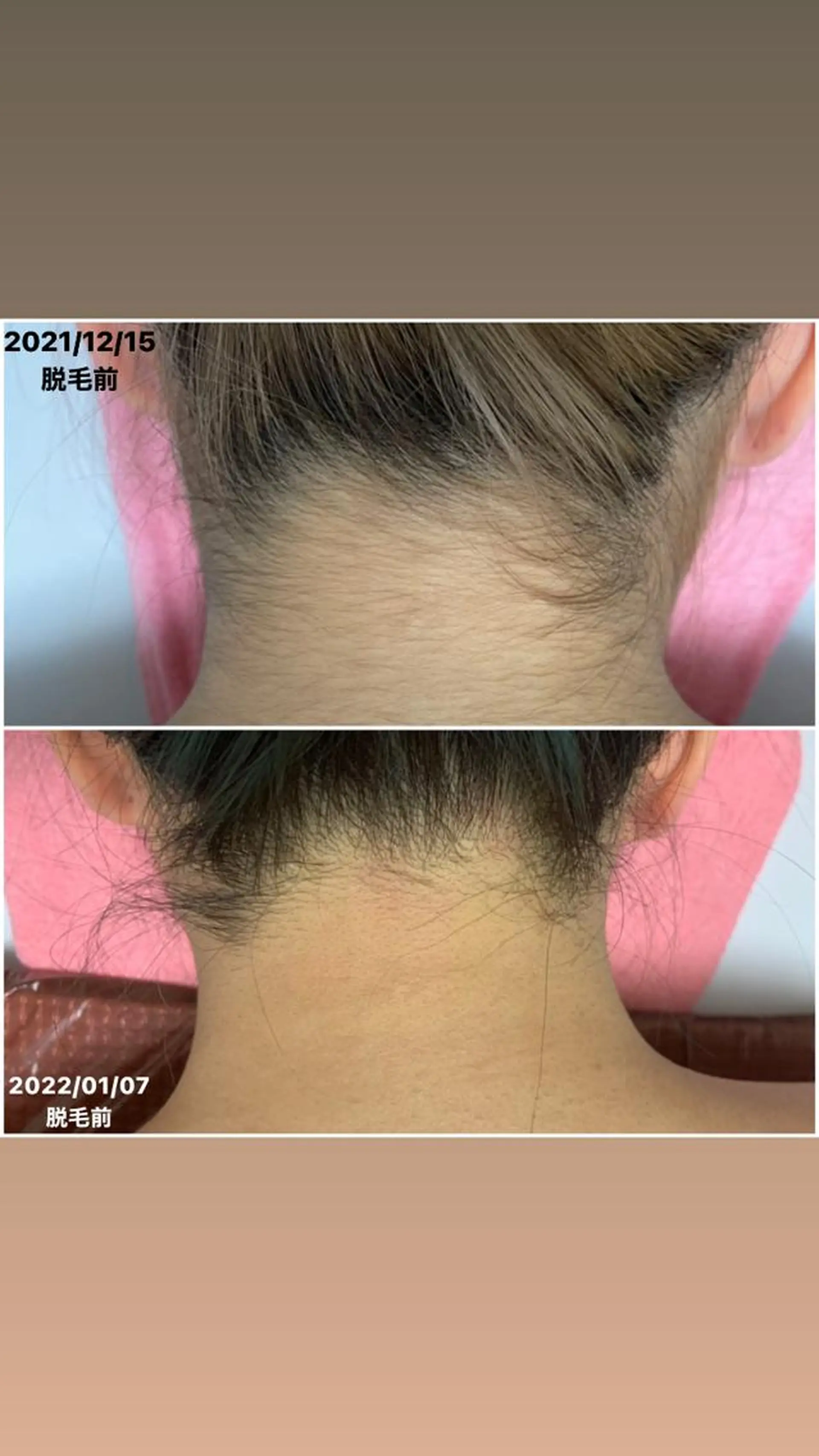 脱毛 透明感の肌Lino malieのエステ・リラクイメージ