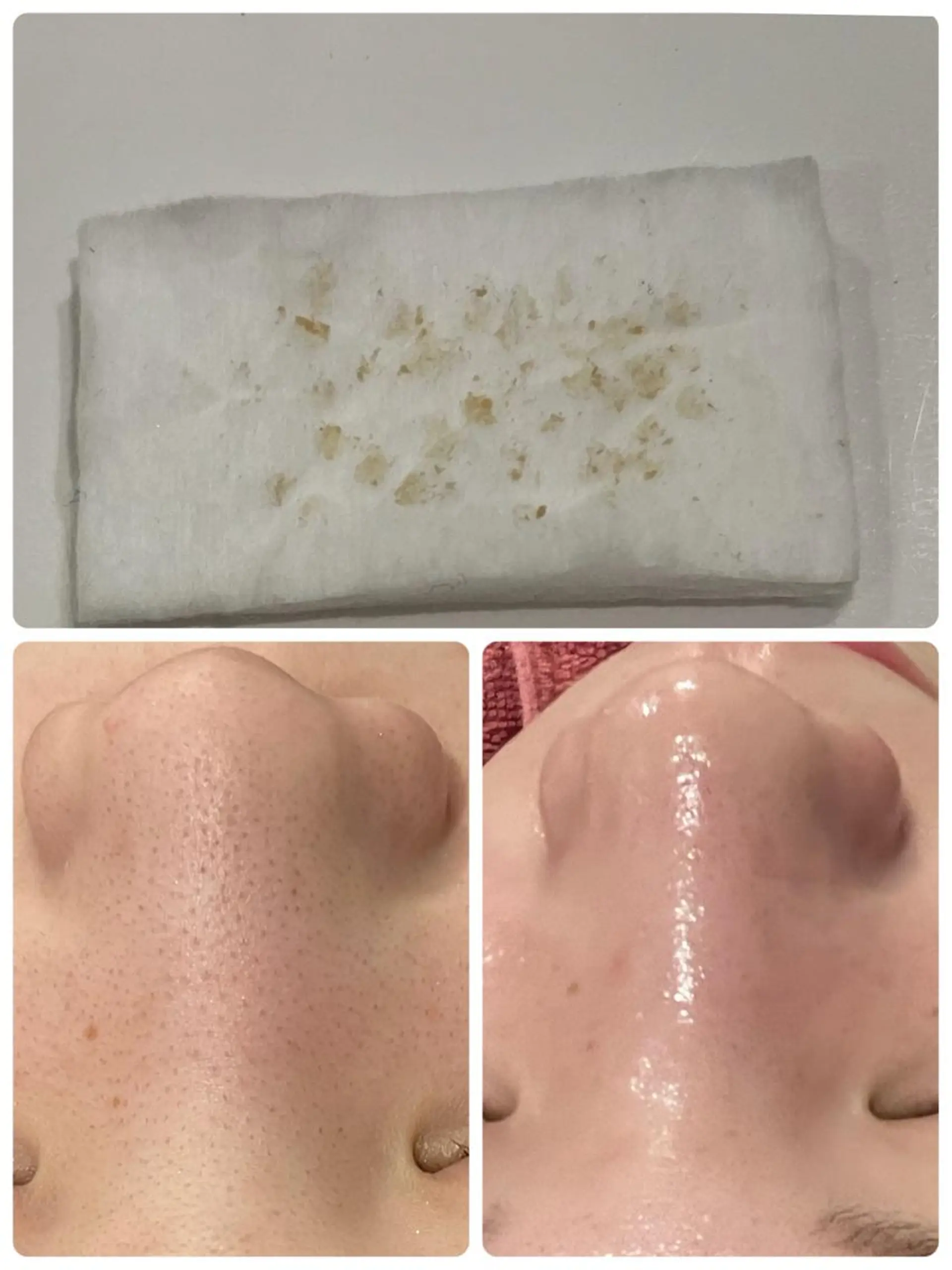 【リベルハーブピーリング認定店】敏感肌・美白脱毛専門店Dione立川店所属・Dione 立川店のエステ・リラクイメージ