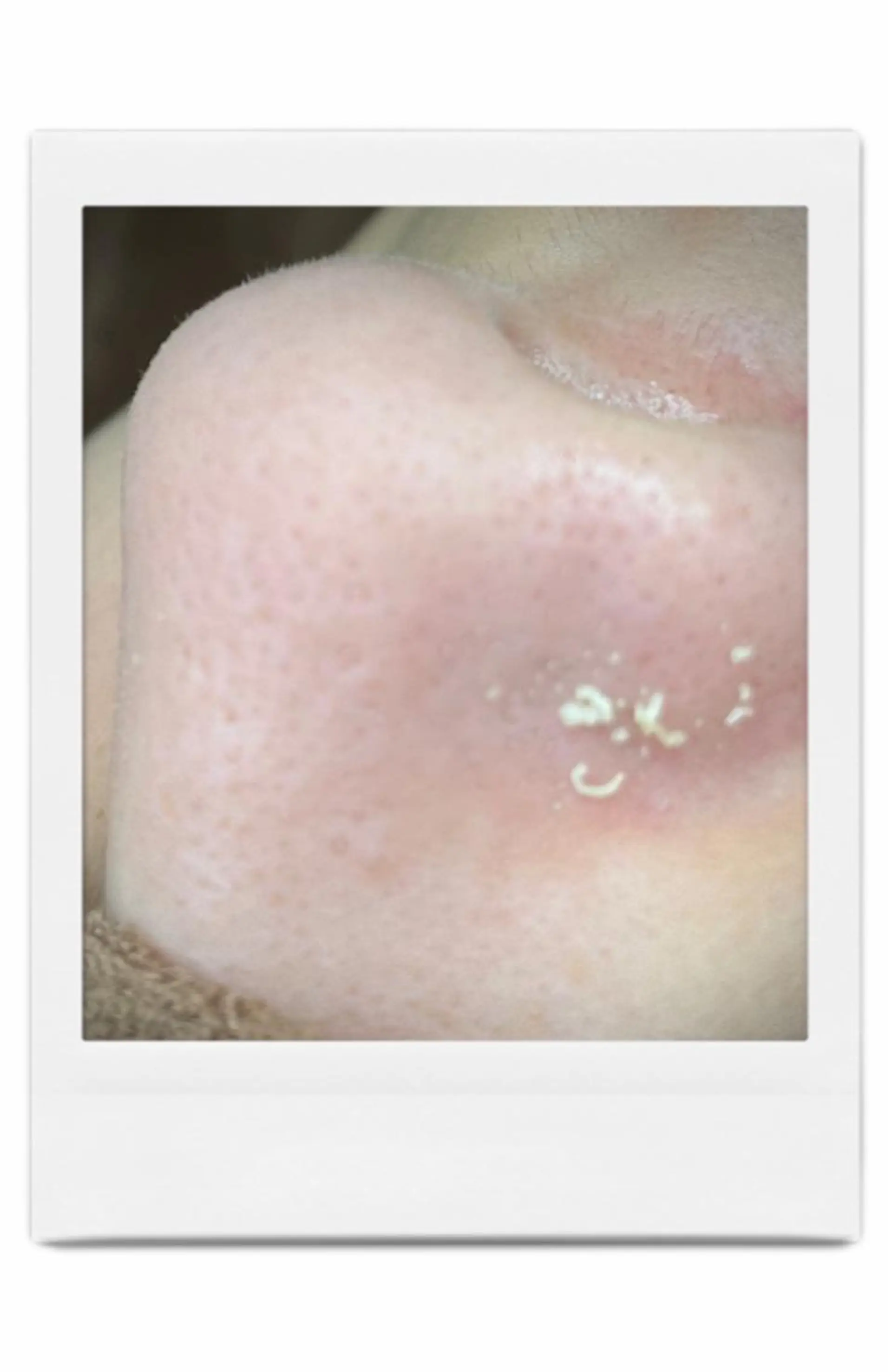 Rifuro毛穴ケア &よもぎ蒸しサロンのエステ・リラクイメージ