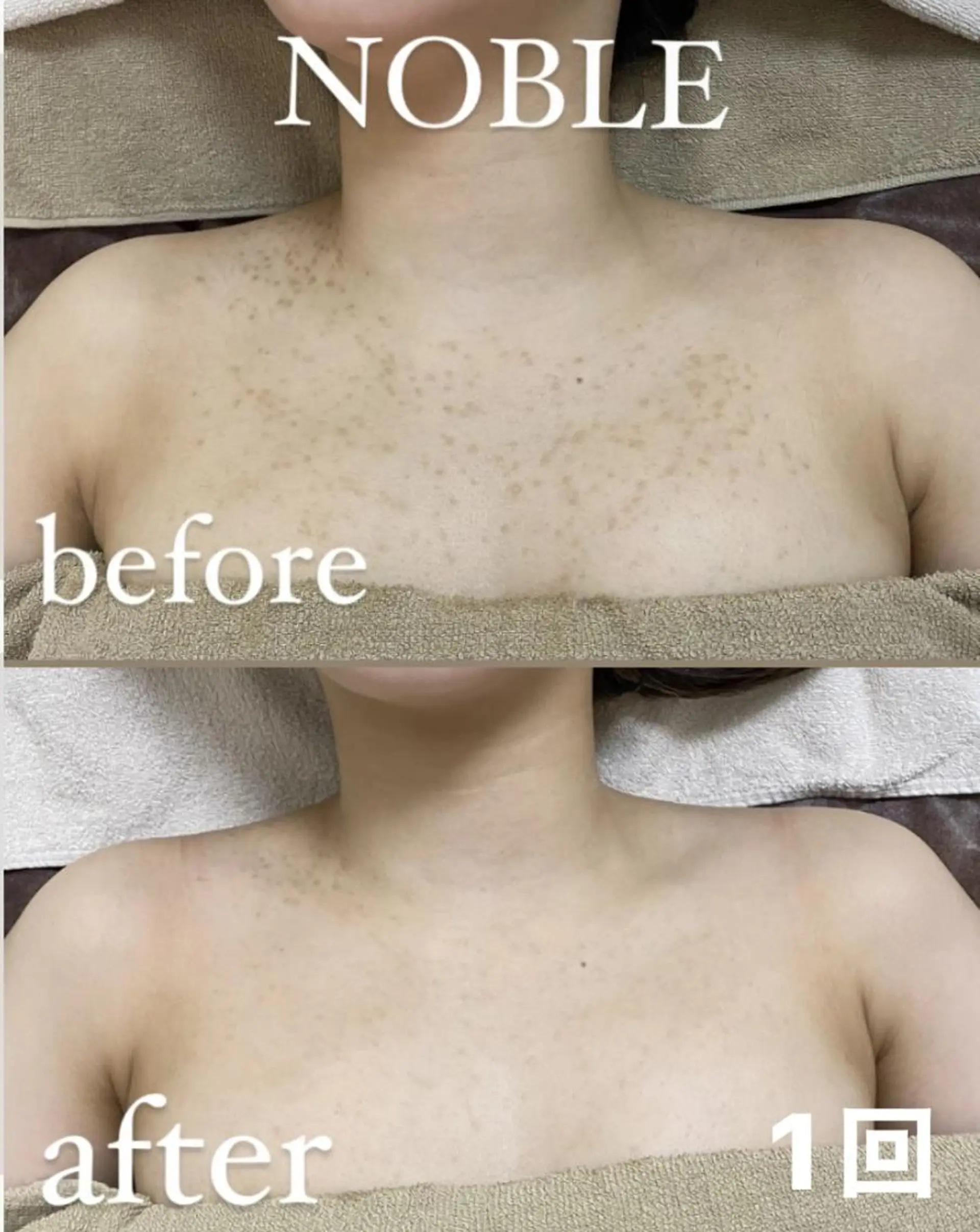 NOBLE 新宿南口店のエステ・リラクイメージ