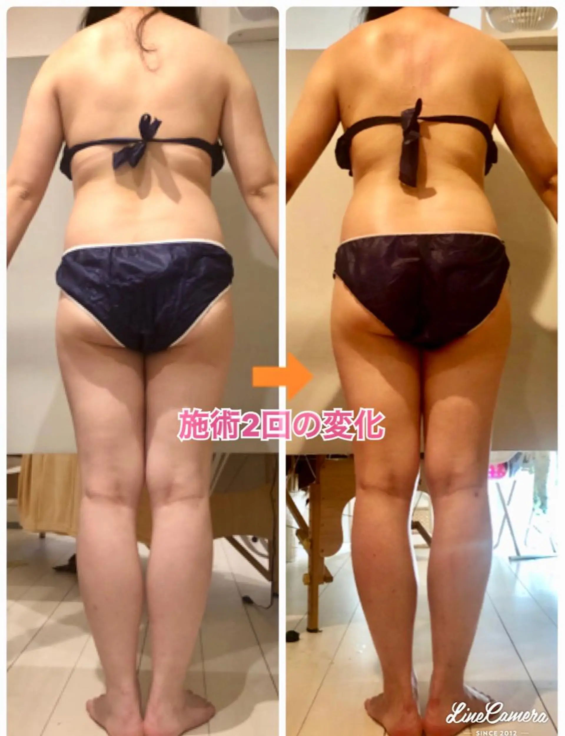 ショート カラー パーマ ヘアアレンジ メンズ キッズ ネイル マツエク・マツパ ‍痩身＆ボディ 結果出し🌟丹野のエステ・リラクイメージ