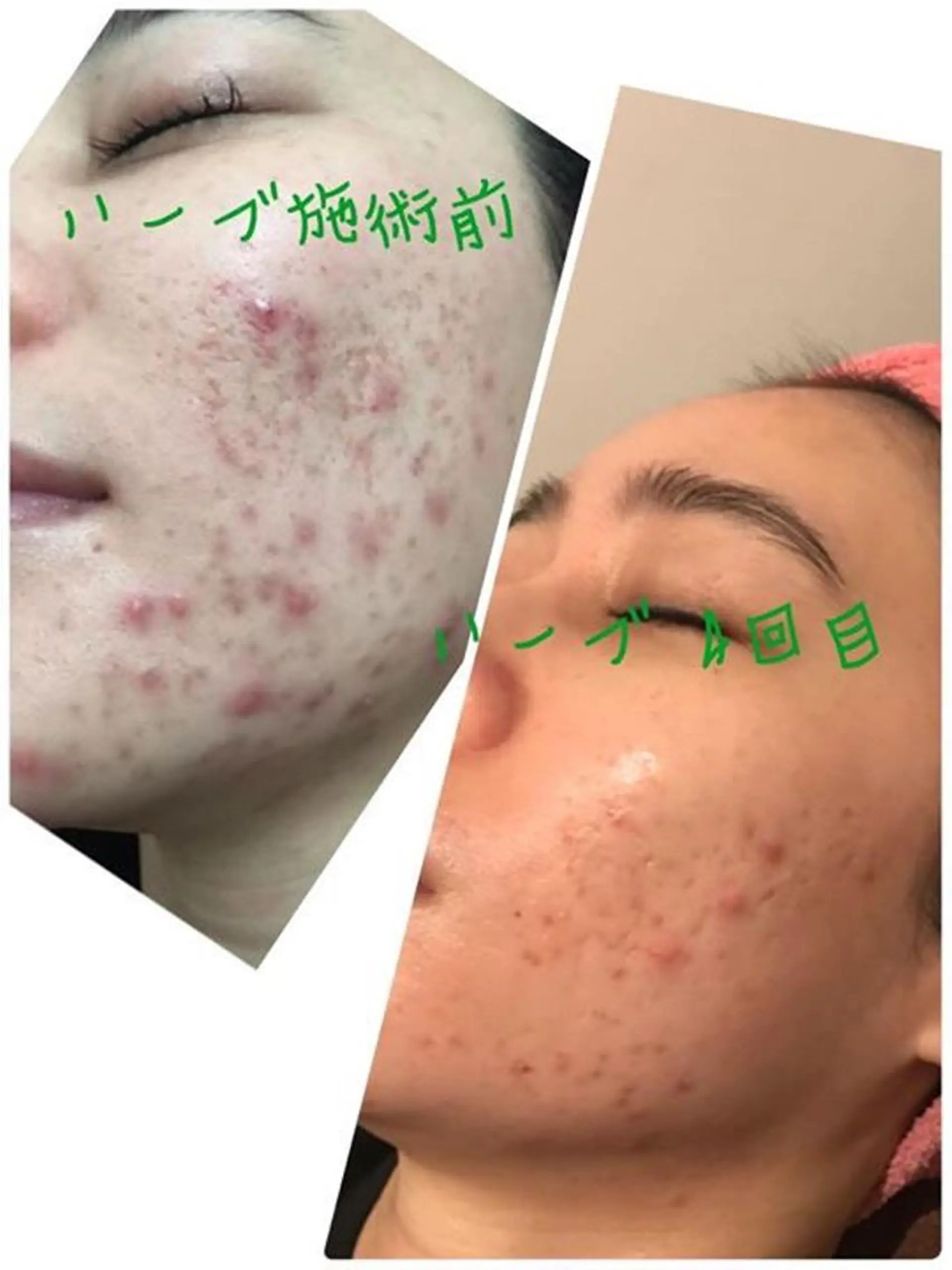 Crown  Jewel所属・CrownJewel クラウン ジュエルのエステ・リラクイメージ