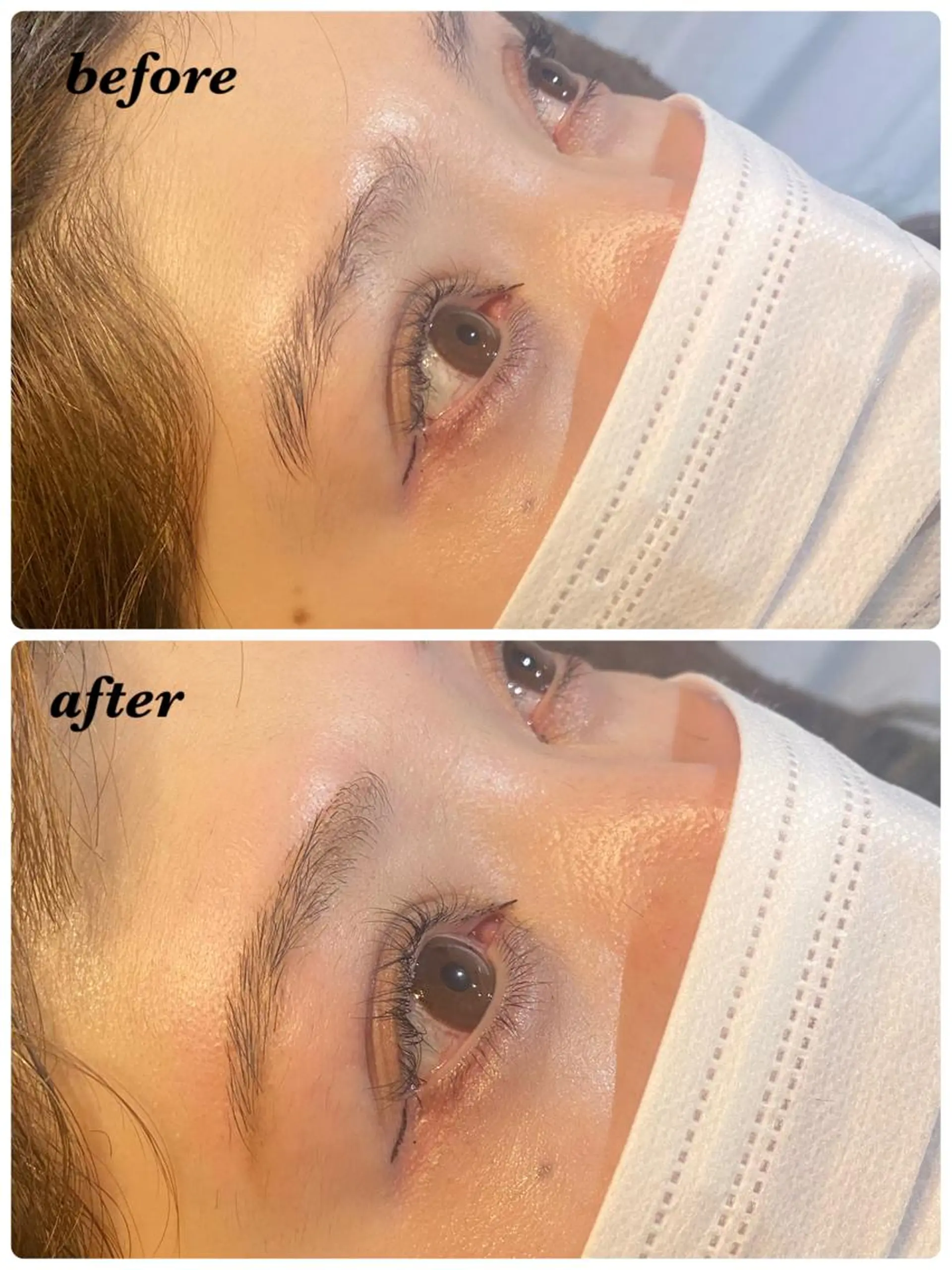 アイブロウ ハーブピーリング/韓国肌管理/フェイシャル/毛穴洗浄/眉毛/顔脱毛【糸脱毛専門】rev所属・ハーブピーリング🌹 毛穴洗浄❤️眉waxのエステ・リラクイメージ