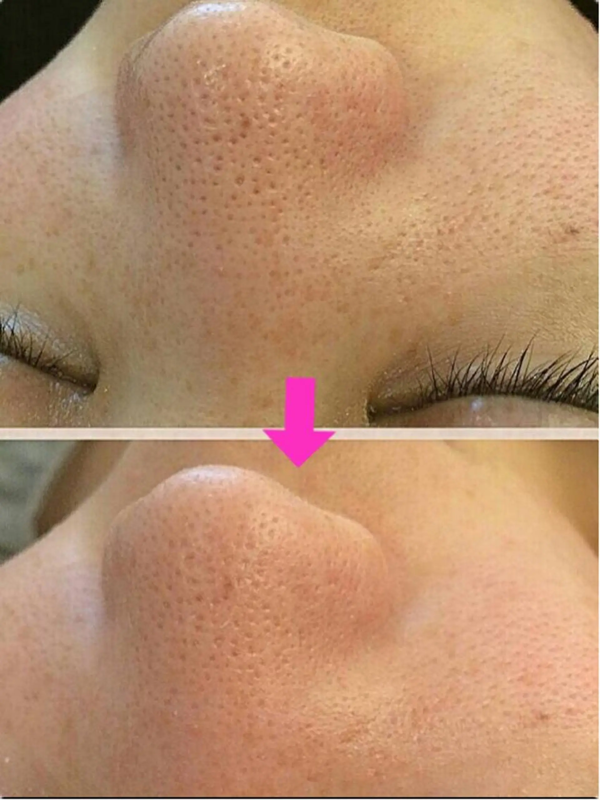 痩身リンパダイエット 隠れ家サロンチャームのエステ・リラクイメージ