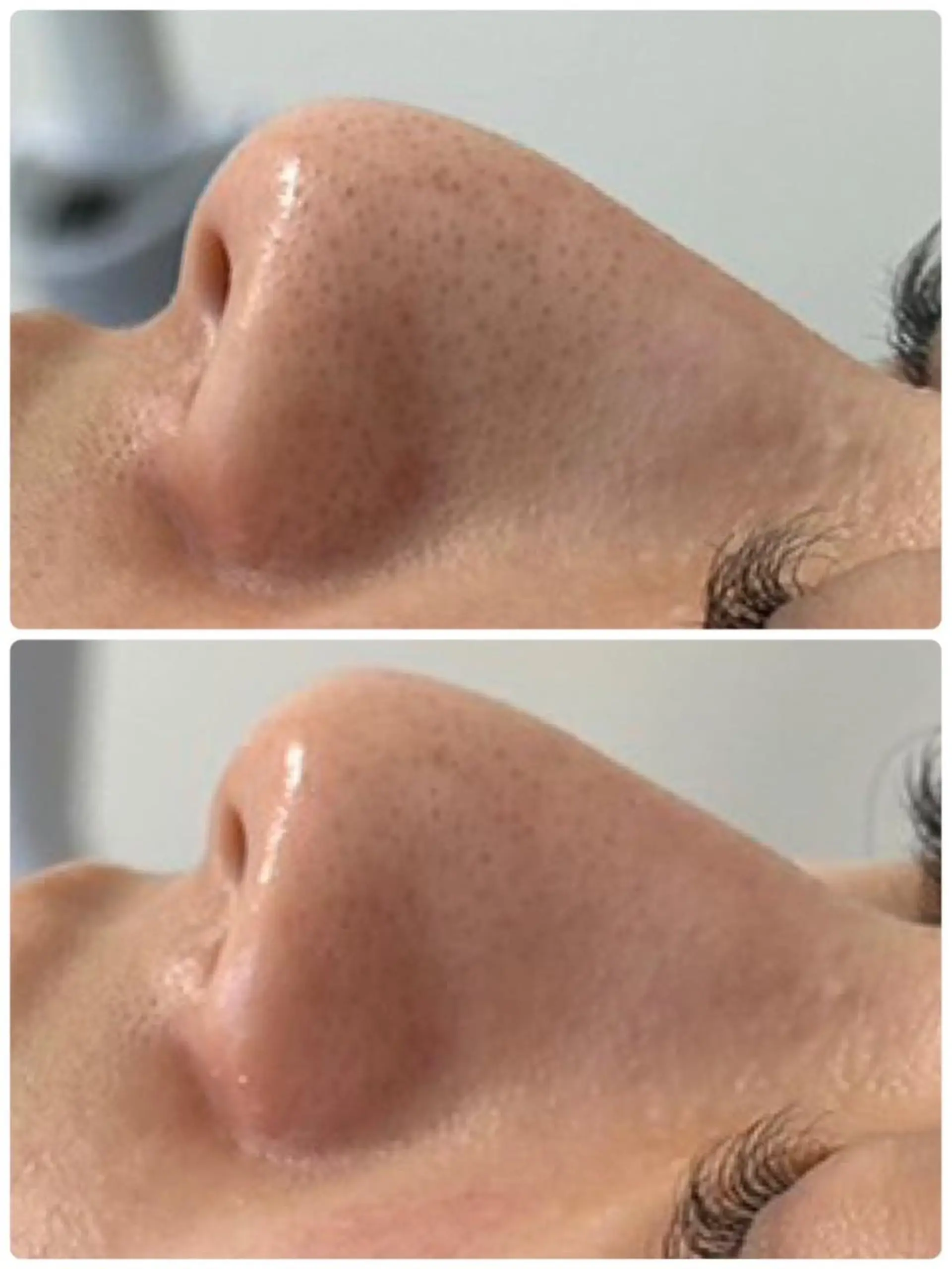 その他 脱毛×肌管理サロン ルネルのエステ・リラクイメージ