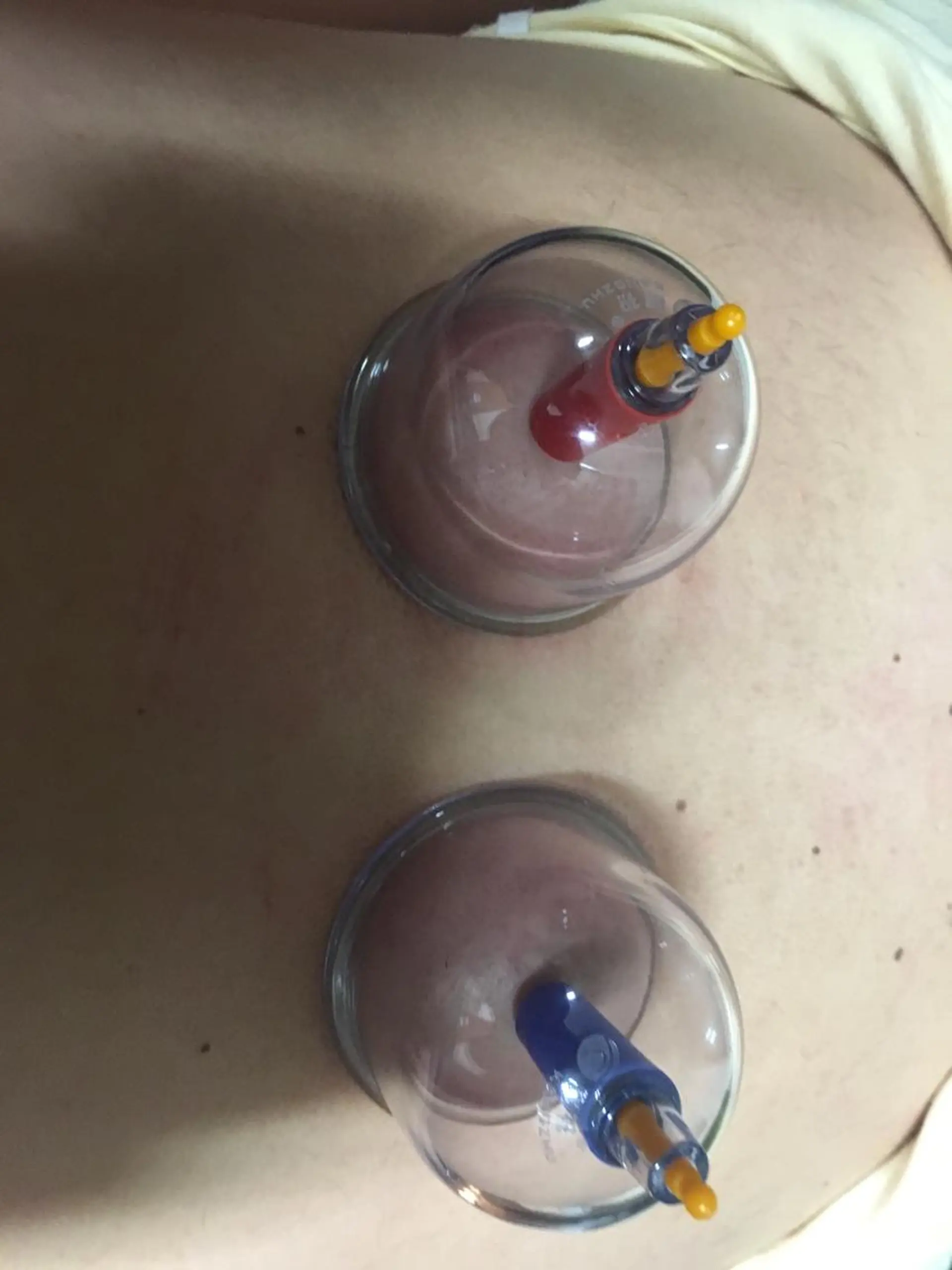 鍼灸サロン RUCEのエステ・リラクイメージ