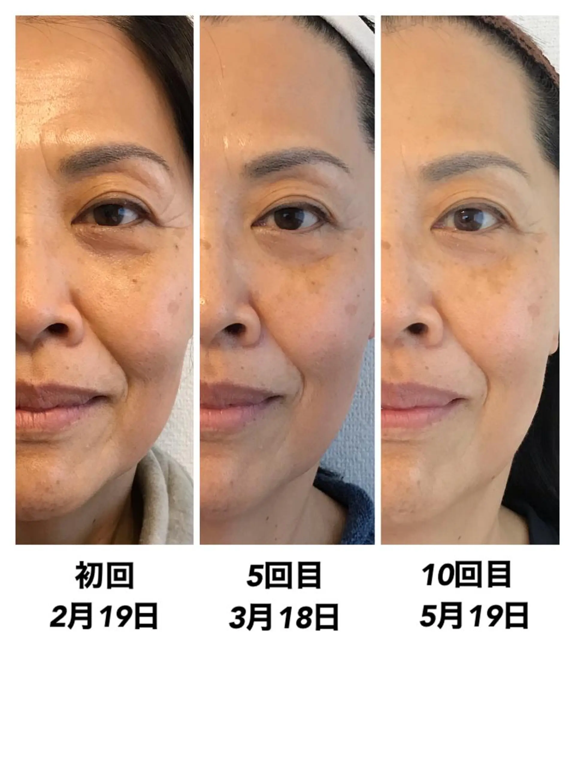 エステティックサロンPartagé【パルタージュ】所属・小尻・太もも痩せる パルタージュのエステ・リラクイメージ