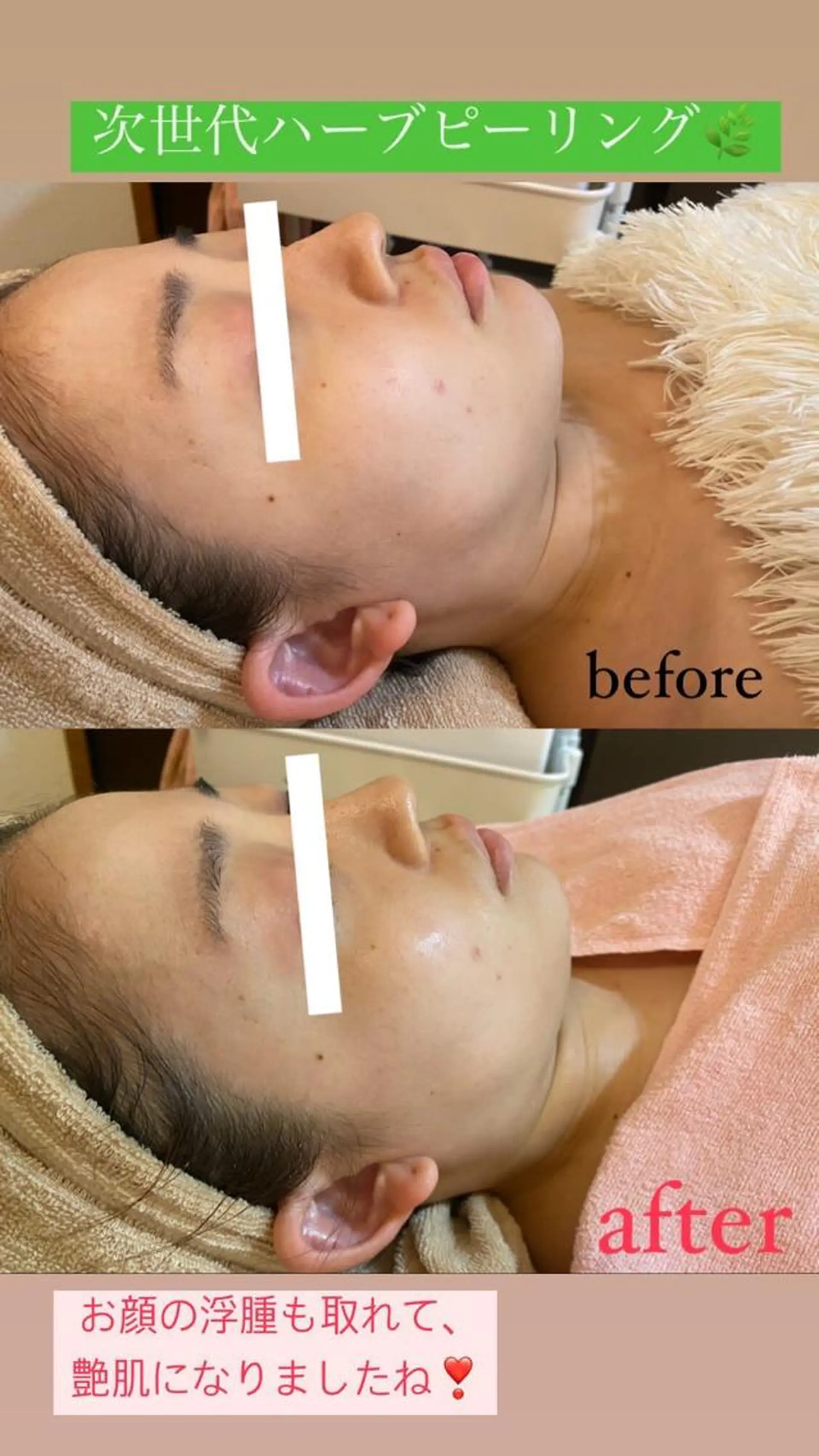 エステ Salon de Lino 御器所のエステ・リラクイメージ