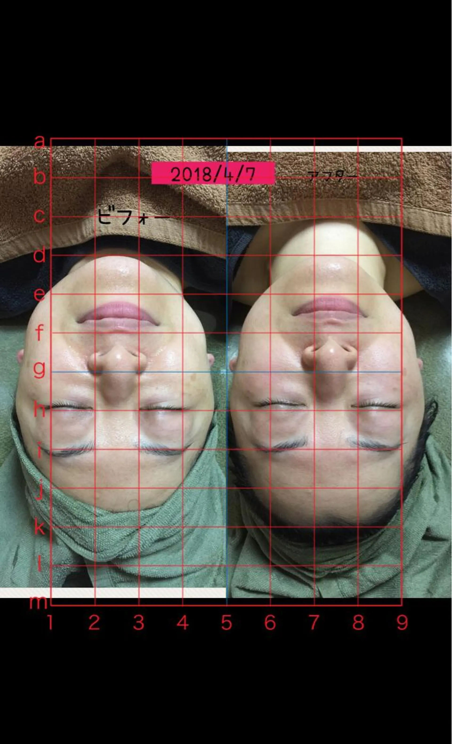 エステ リラク ベルデ106 verde106のエステ・リラクイメージ