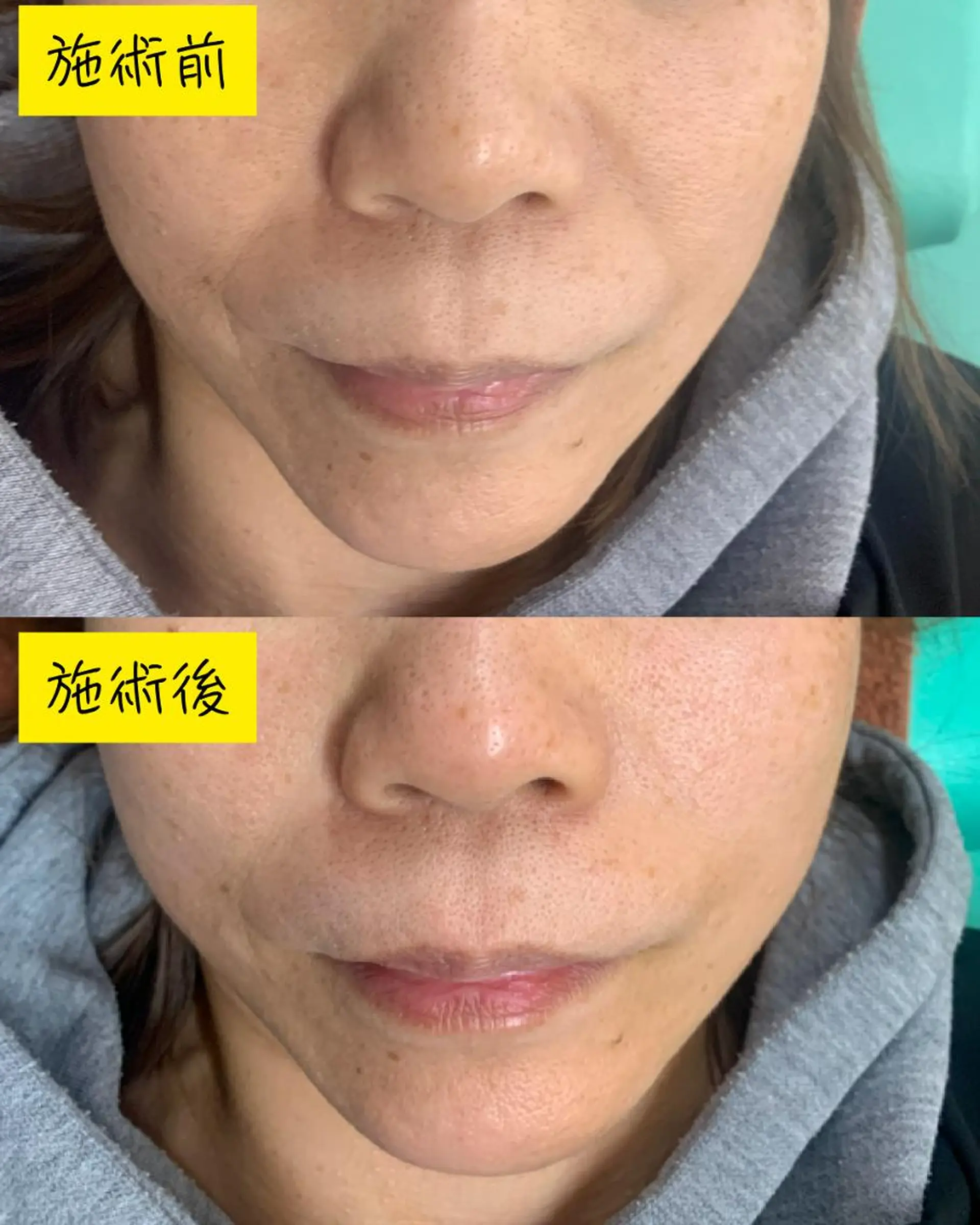 エステ リラク 河輪 鍼灸接骨院のエステ・リラクイメージ