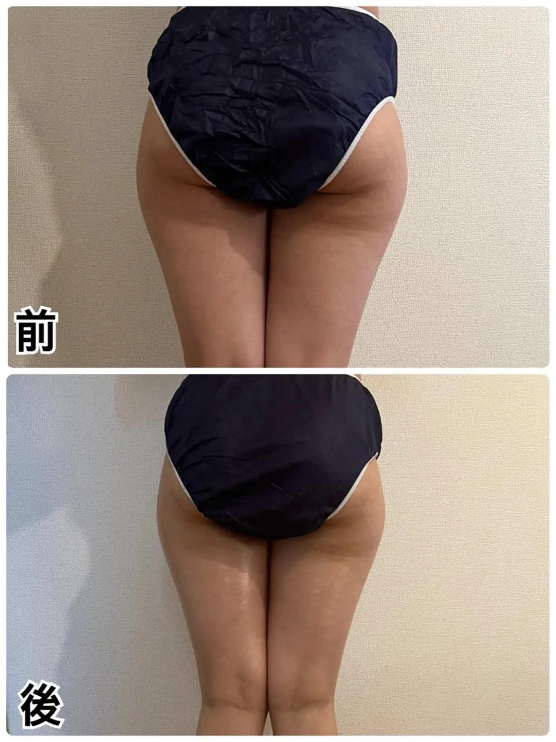 ❤︎MN❤︎ モンのエステ・リラクイメージ