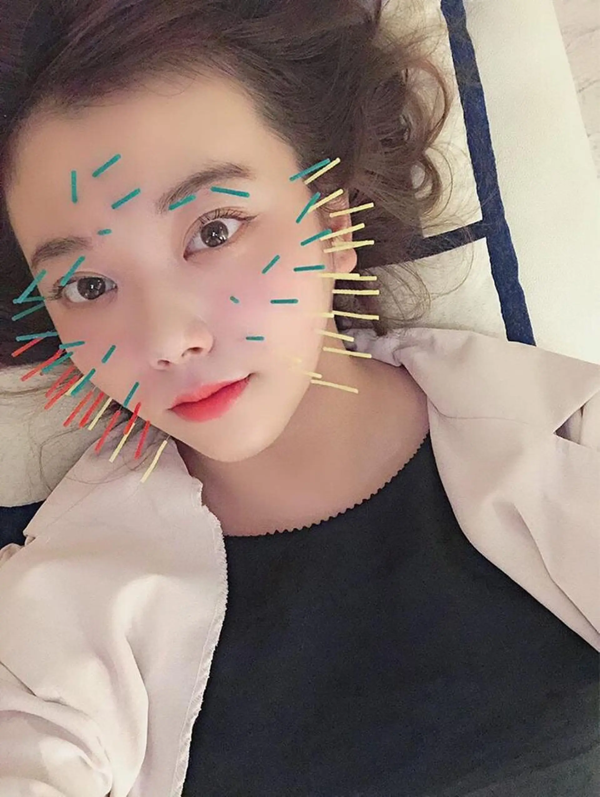 鍼灸整骨院Refine所属・鍼灸 Refineのその他イメージ