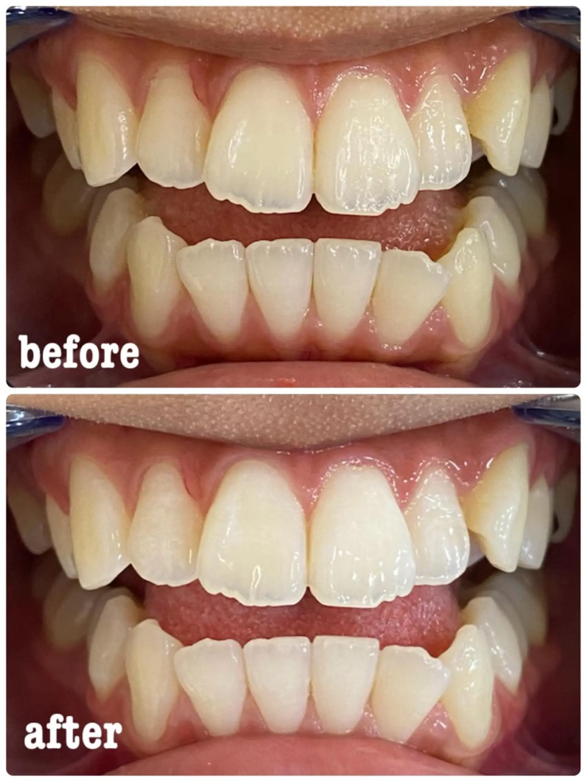 ホワイトニングサロン ラウレアのその他イメージ