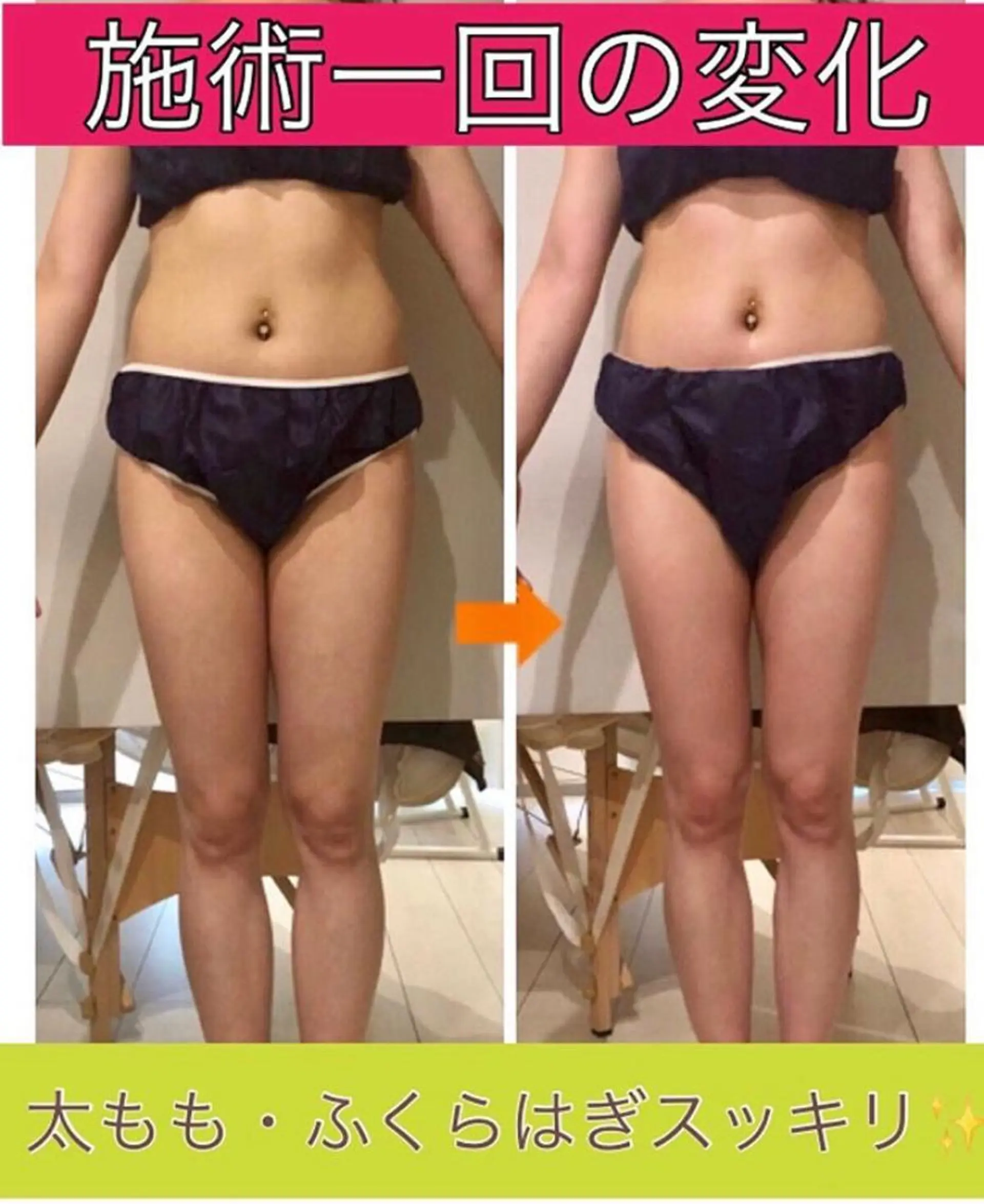 ショート カラー パーマ ヘアアレンジ メンズ キッズ ネイル マツエク・マツパ エステ リラク ‍痩身＆ボディ 結果出し🌟丹野のエステ・リラクイメージ