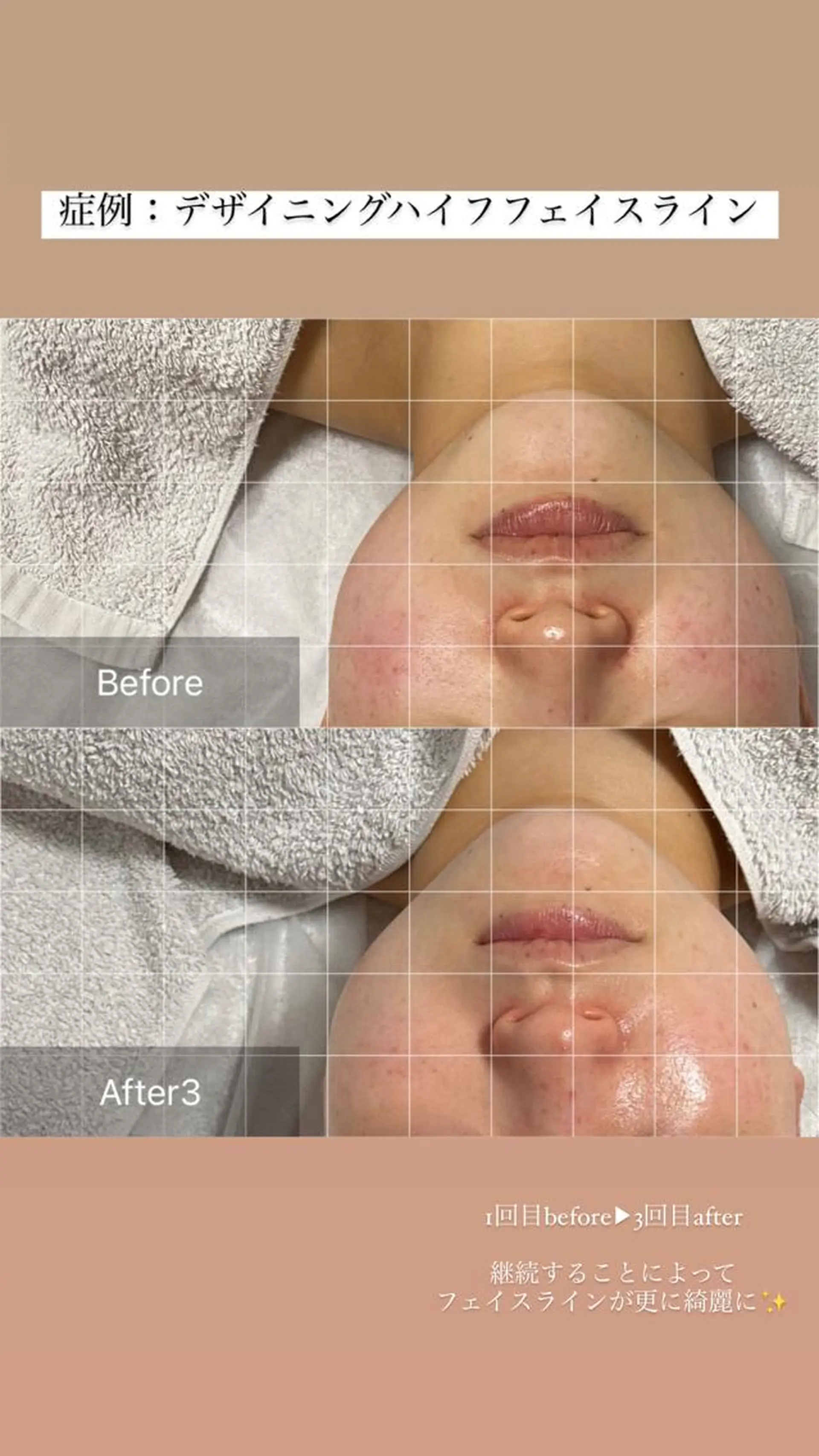 ALIA Scintiller  アリアサンティエ所属・齋藤 祐里耶のエステ・リラクイメージ