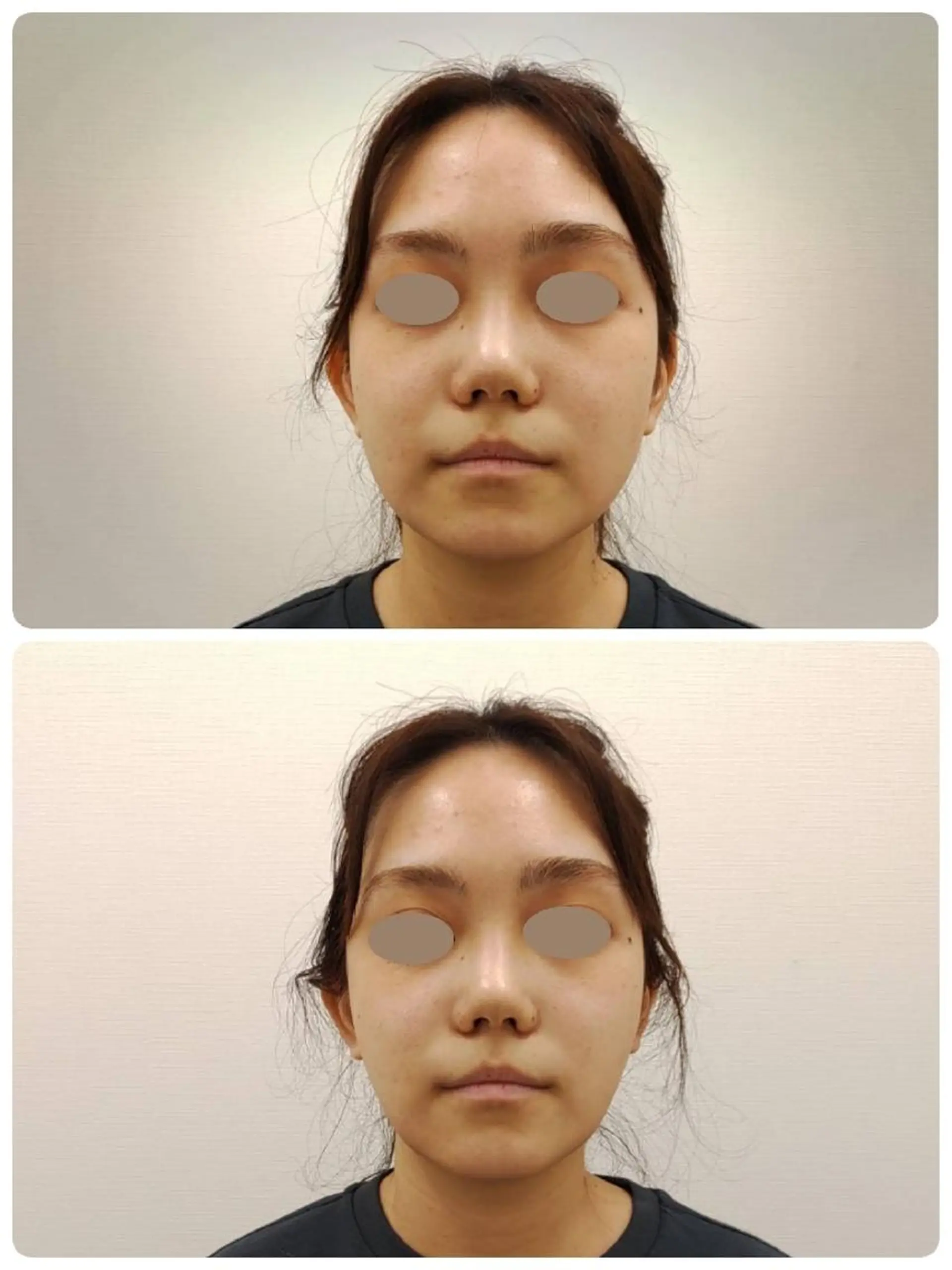 エステ リラク CORAL湘南平塚店所属・【小顔・美容専門】 🐠リカのエステ・リラクイメージ