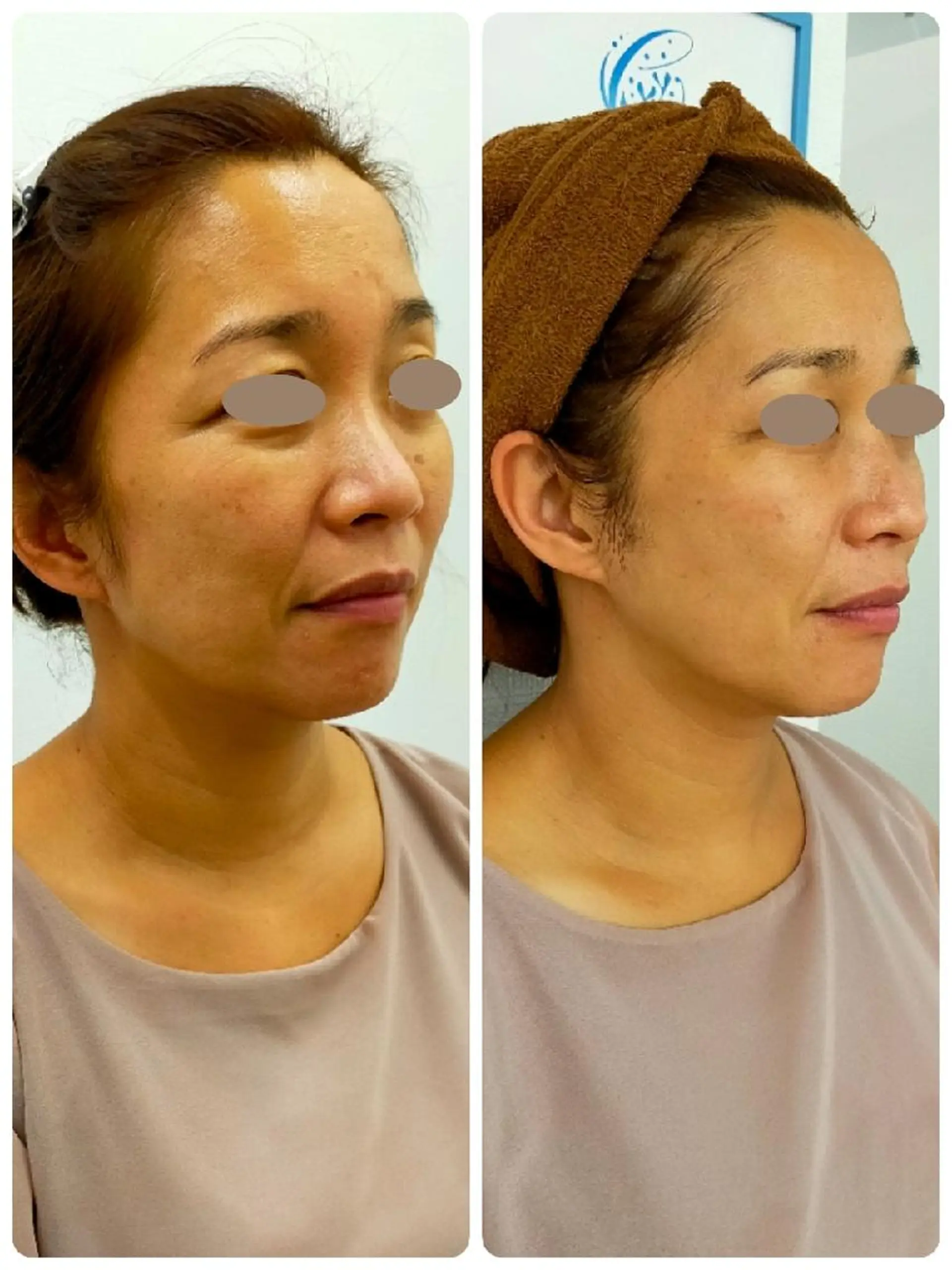 エステ リラク CORAL湘南平塚店所属・【小顔・美容専門】 🐠リカのエステ・リラクイメージ