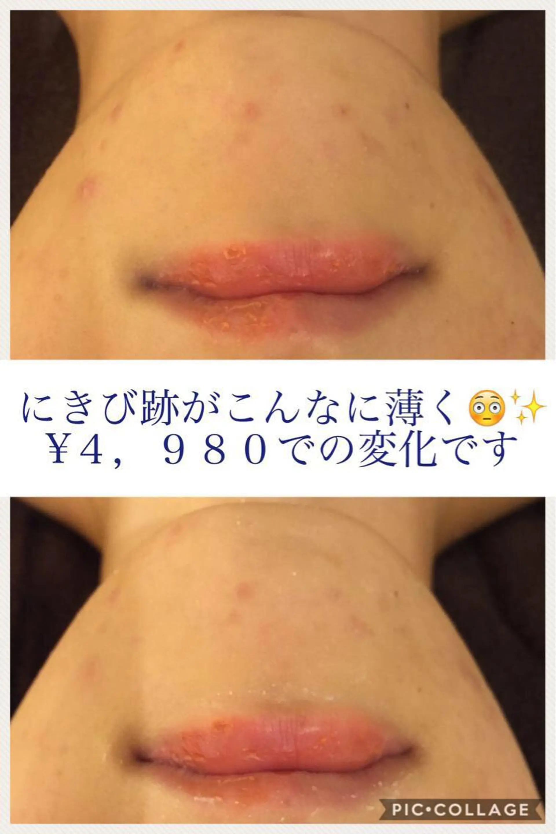 ミディアム カラー パーマ ヘアアレンジ メンズ キッズ ネイル マツエク・マツパ ニキビ・肌質改善専門 ♡人生が変わるサロンのエステ・リラクイメージ