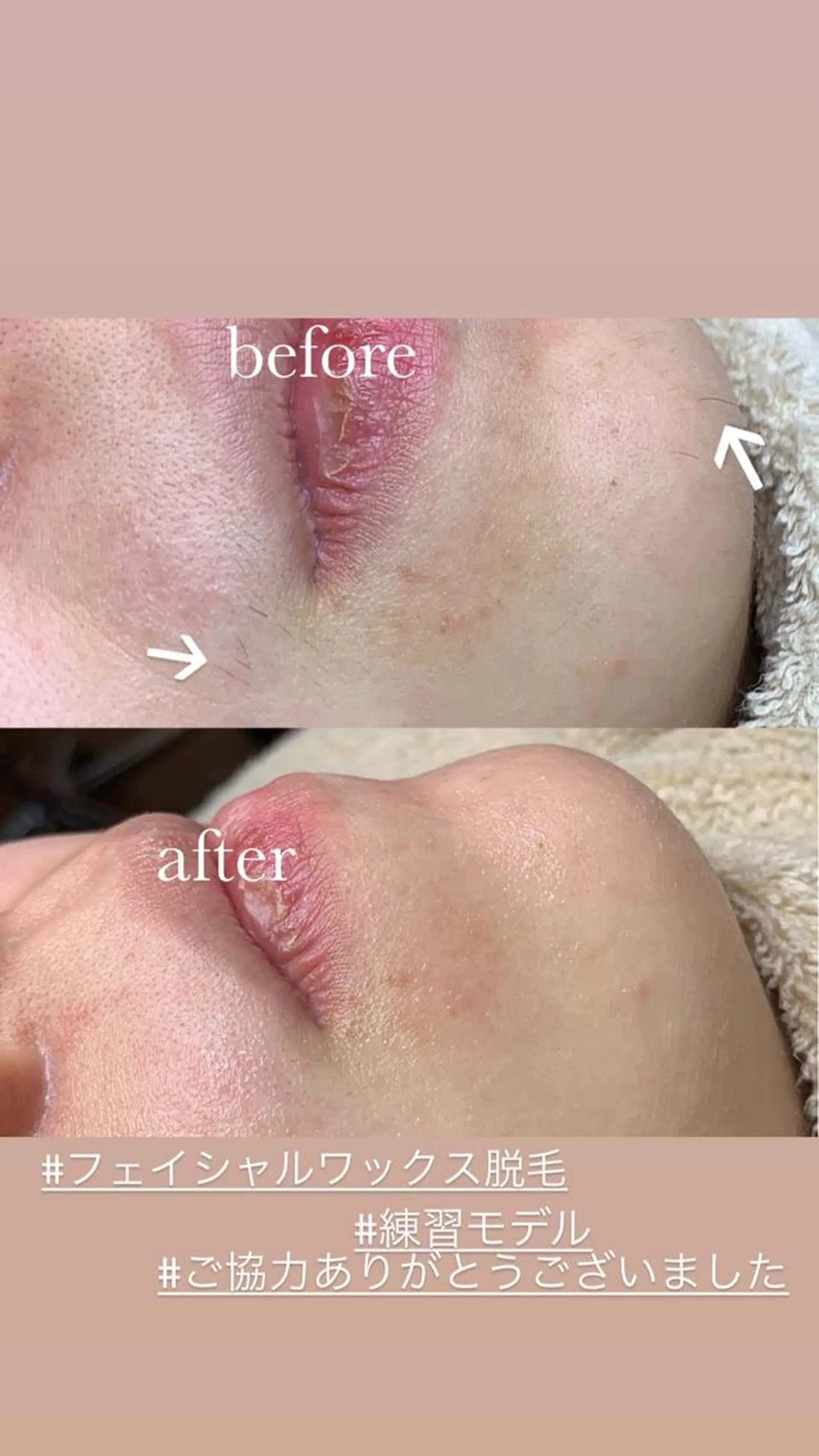 脱毛 Pua Meliaのマツエク・マツパデザイン