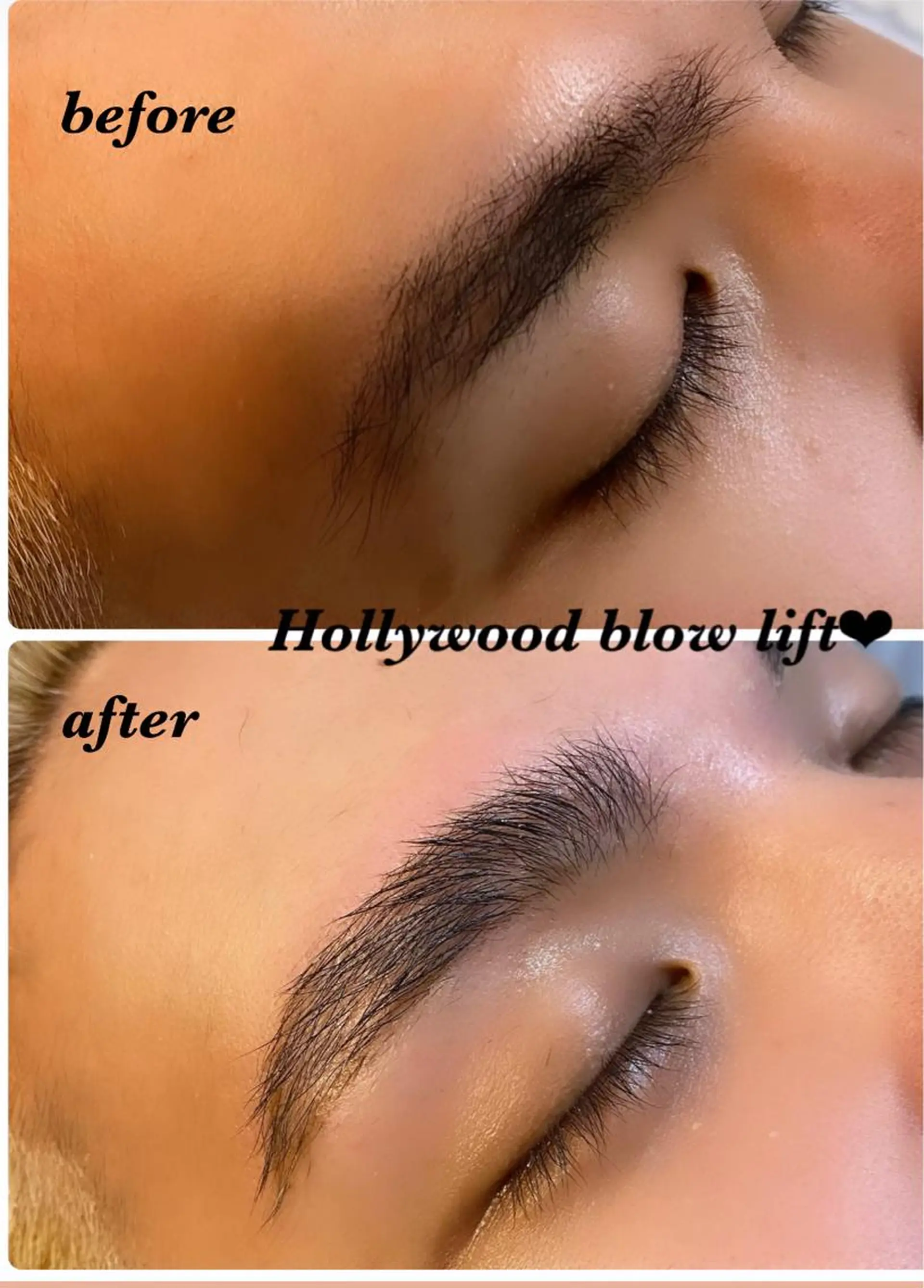 アイブロウ ハーブピーリング/韓国肌管理/フェイシャル/毛穴洗浄/眉毛/顔脱毛【糸脱毛専門】rev所属・ハーブピーリング🌹 毛穴洗浄❤️眉waxのエステ・リラクイメージ