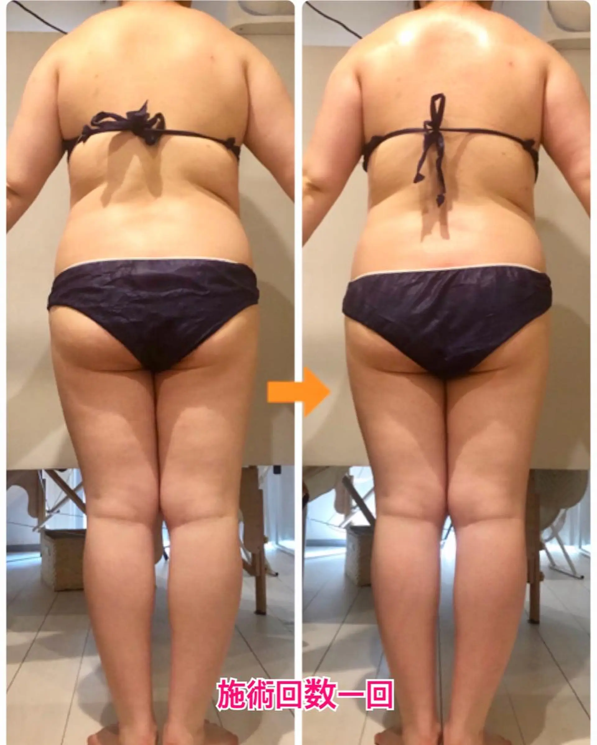 ロング カラー パーマ ヘアアレンジ メンズ キッズ ネイル マツエク・マツパ ‍痩身＆ボディ 結果出し🌟丹野のエステ・リラクイメージ