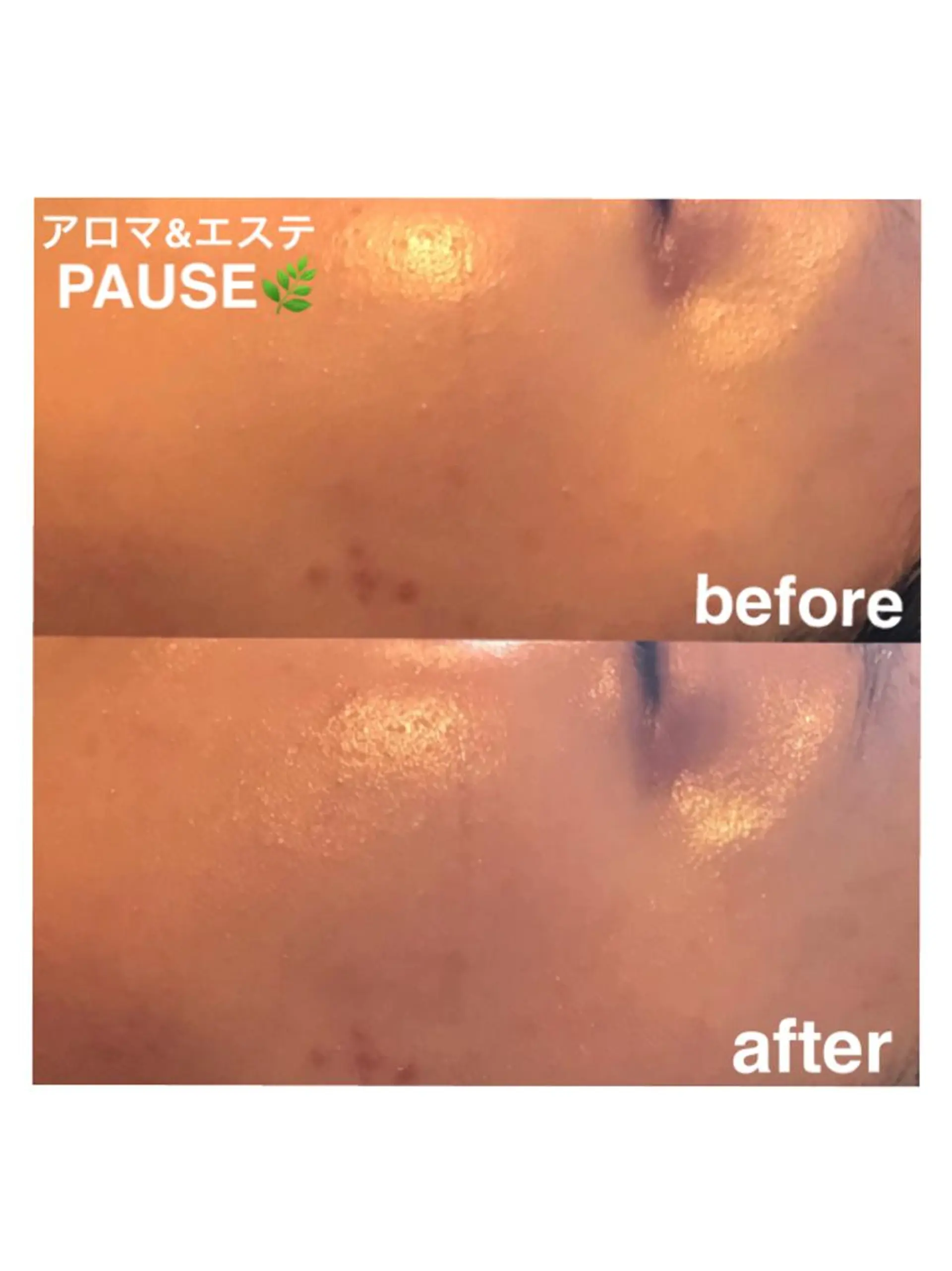 エステ 浜野 恵美のエステ・リラクイメージ