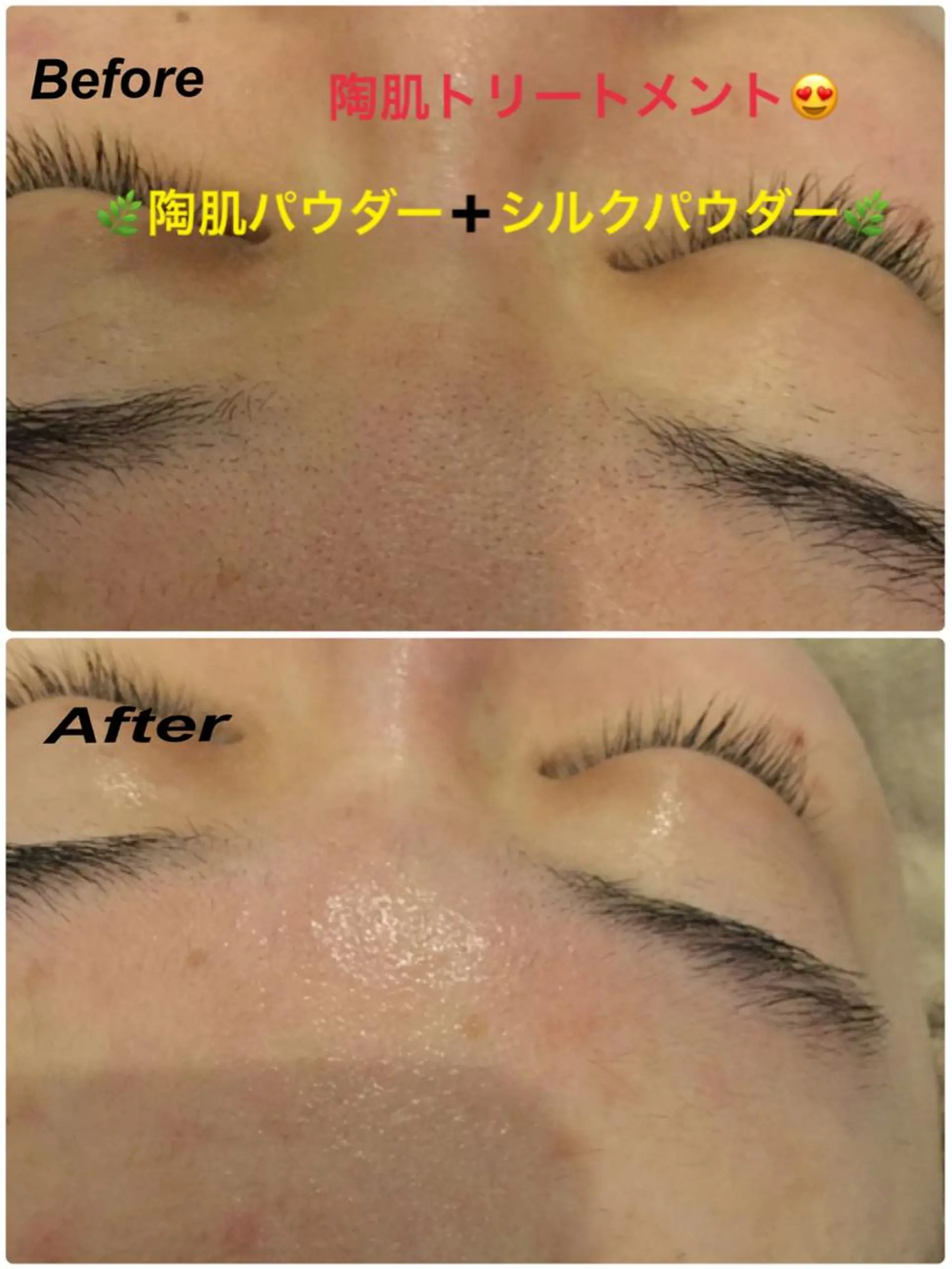 エステ 【リベルハーブピーリング認定店】敏感肌・美白脱毛専門店Dione立川店所属・Dione 立川店のエステ・リラクイメージ